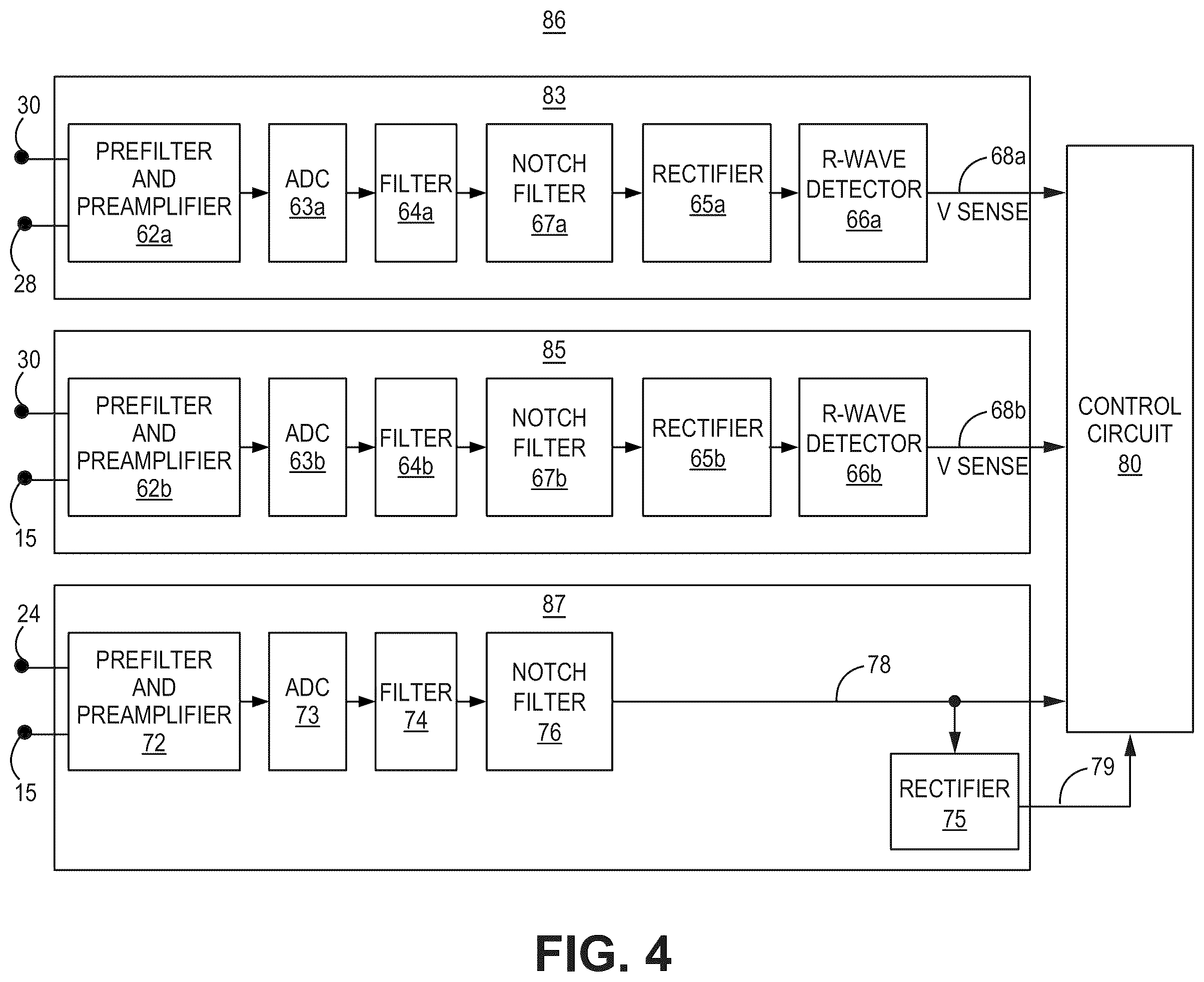 Patent US12569688 Figure 7 – Medical device and method for detecting arrhythmia