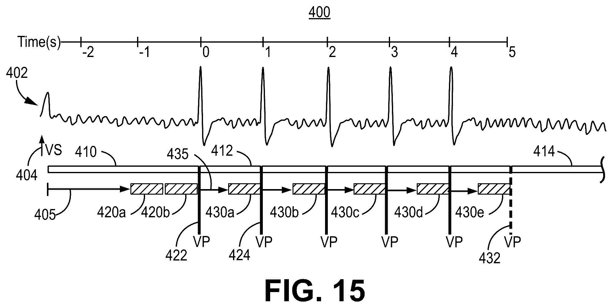 Patent US12569688 Figure 15 – Medical device and method for detecting arrhythmia