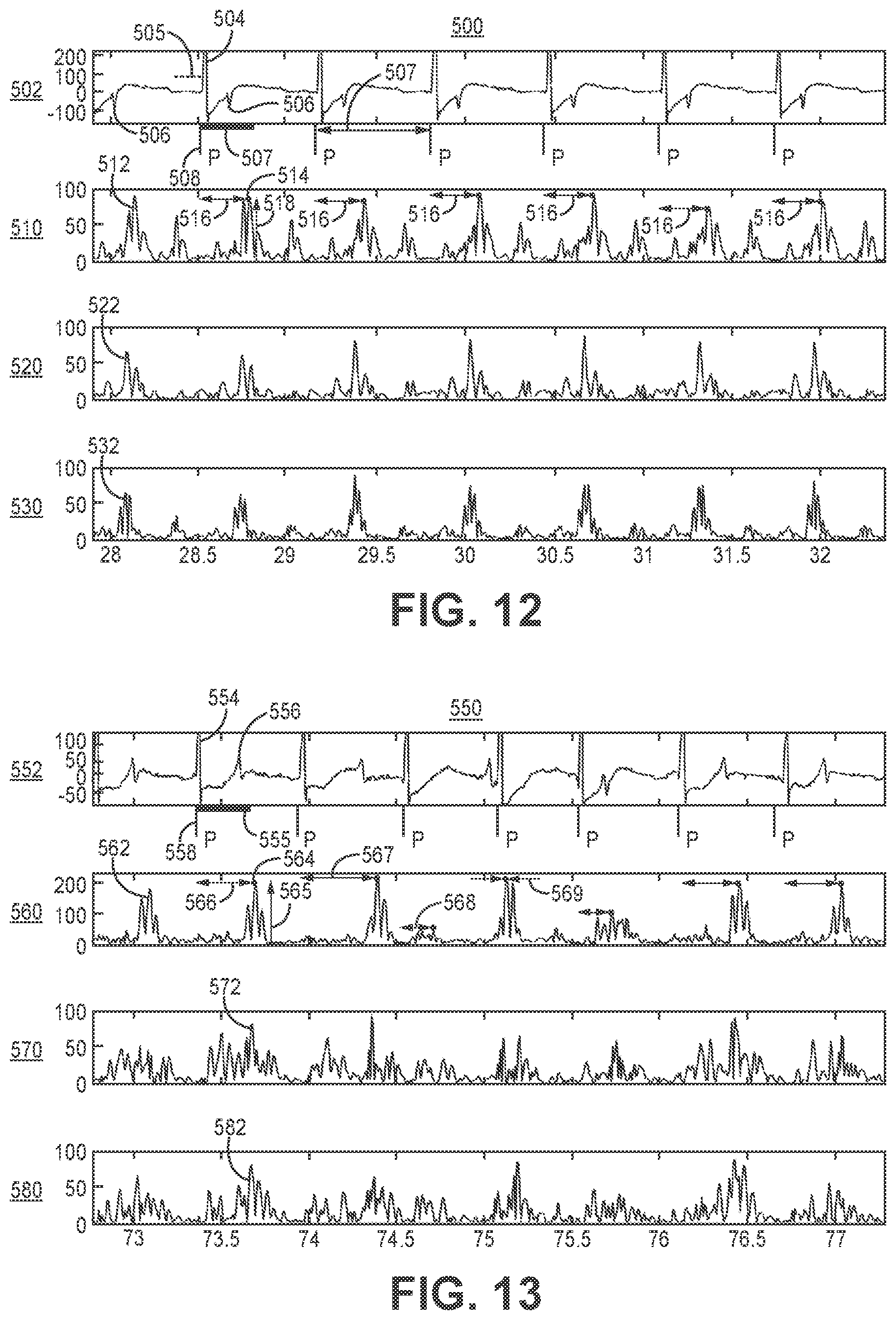Patent US12569689 Figure 10 – Medical device and method for detecting atrioventricular block