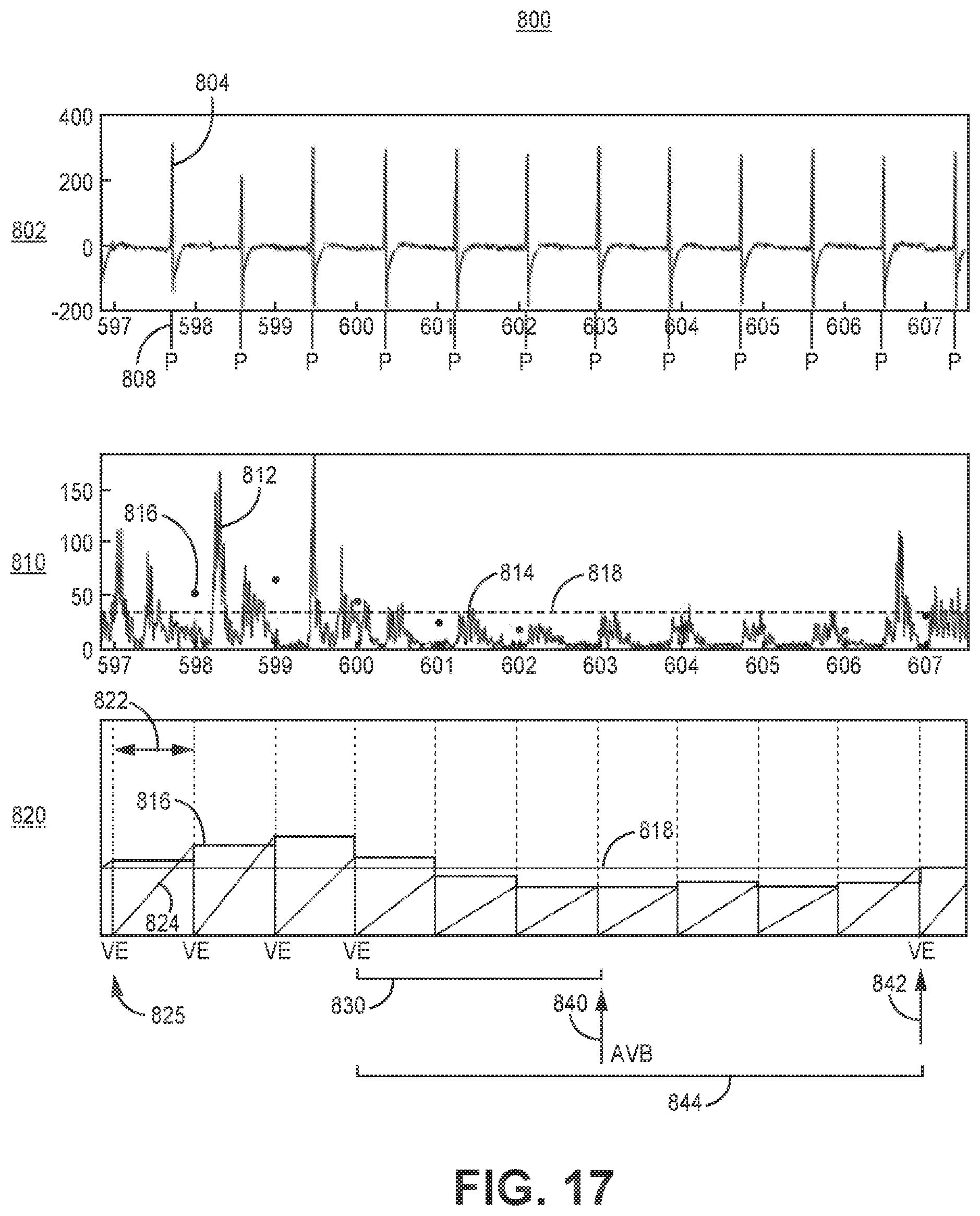 Patent US12569689 Figure 14 – Medical device and method for detecting atrioventricular block
