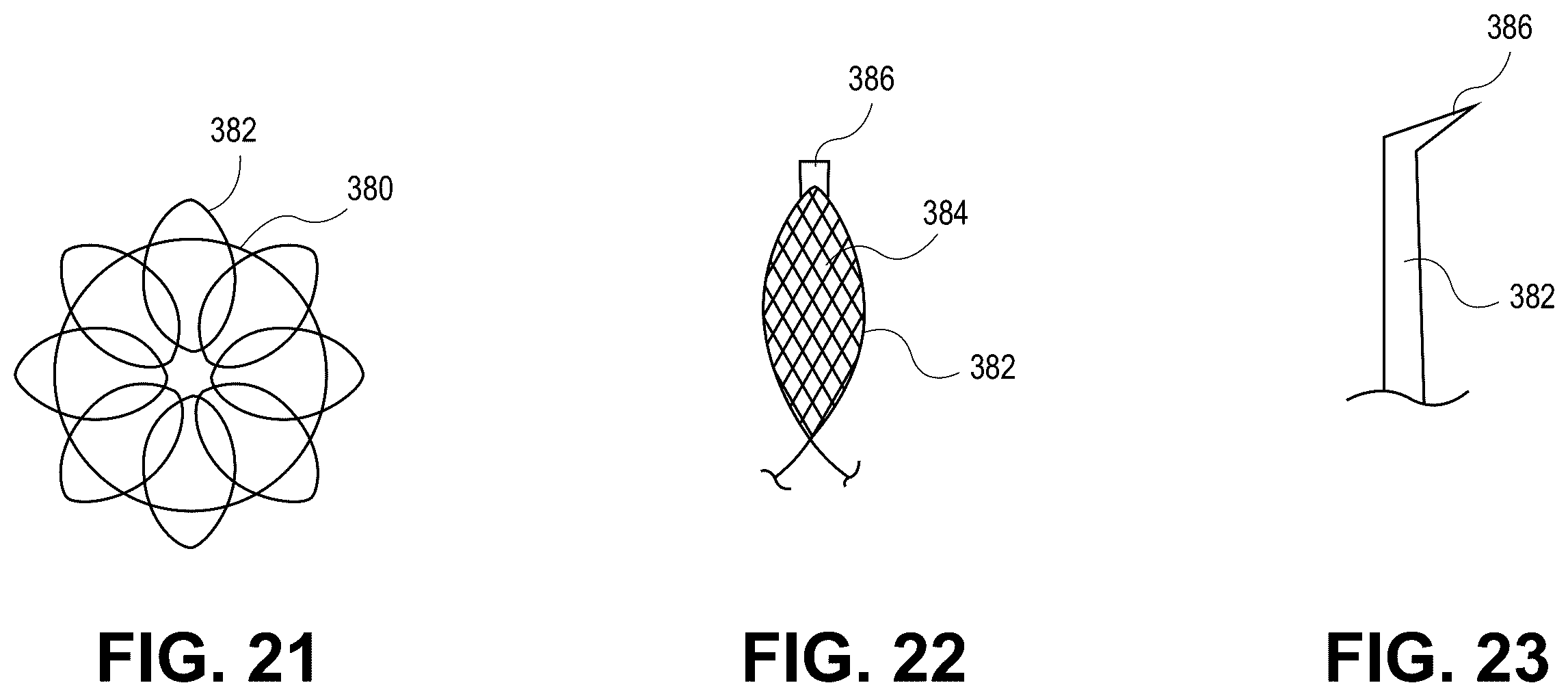 Patent US12569691 Figure 11 – Atrial appendage occlusion and arrhythmia tratment