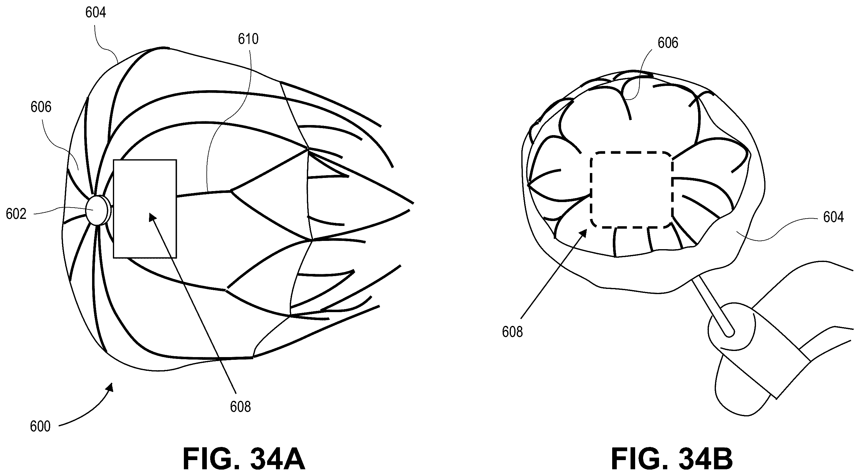 Patent US12569691 Figure 16 – Atrial appendage occlusion and arrhythmia tratment