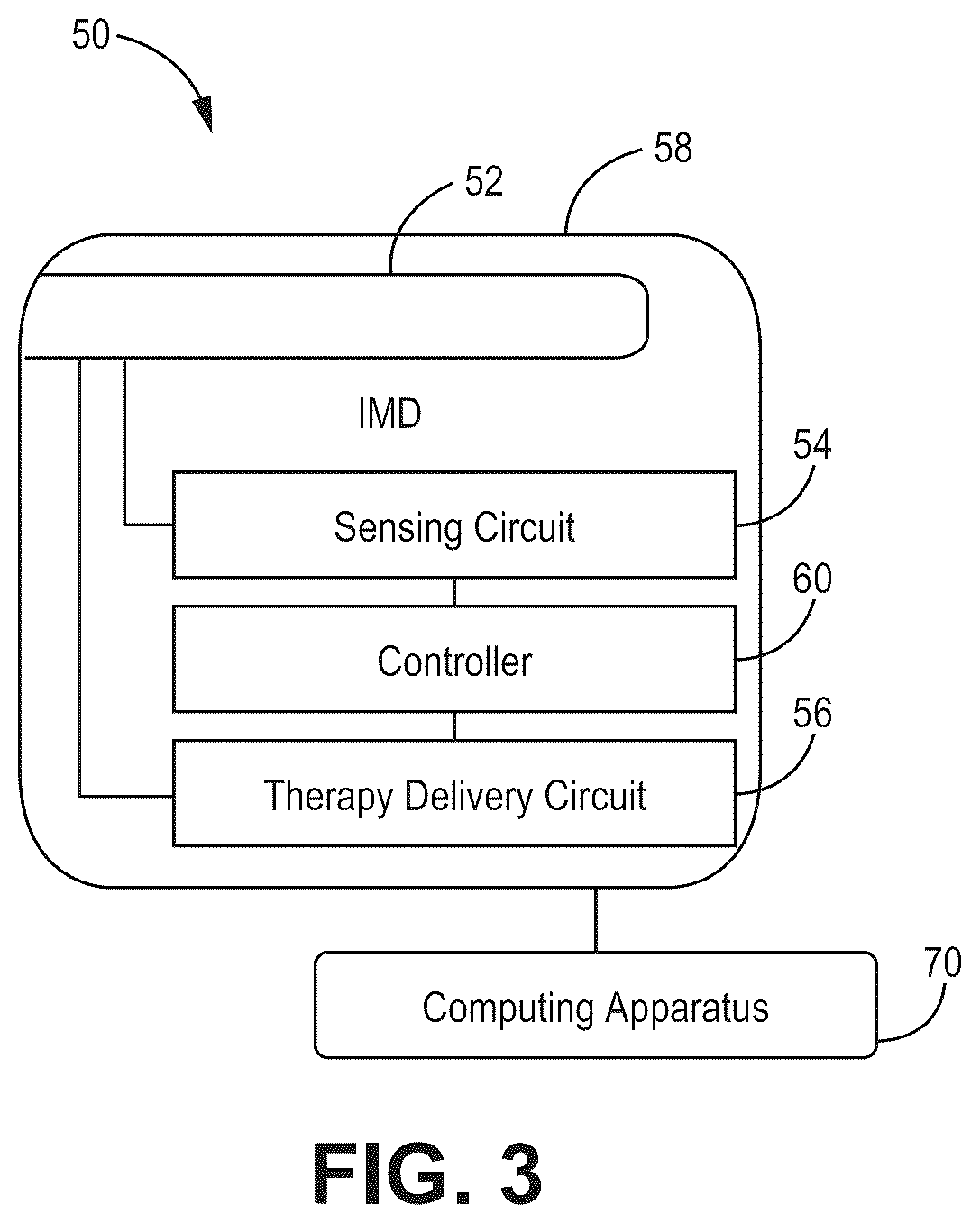 Patent US12569694 Figure 3 – Adjustable lead systems for cardiac septal wall implantation