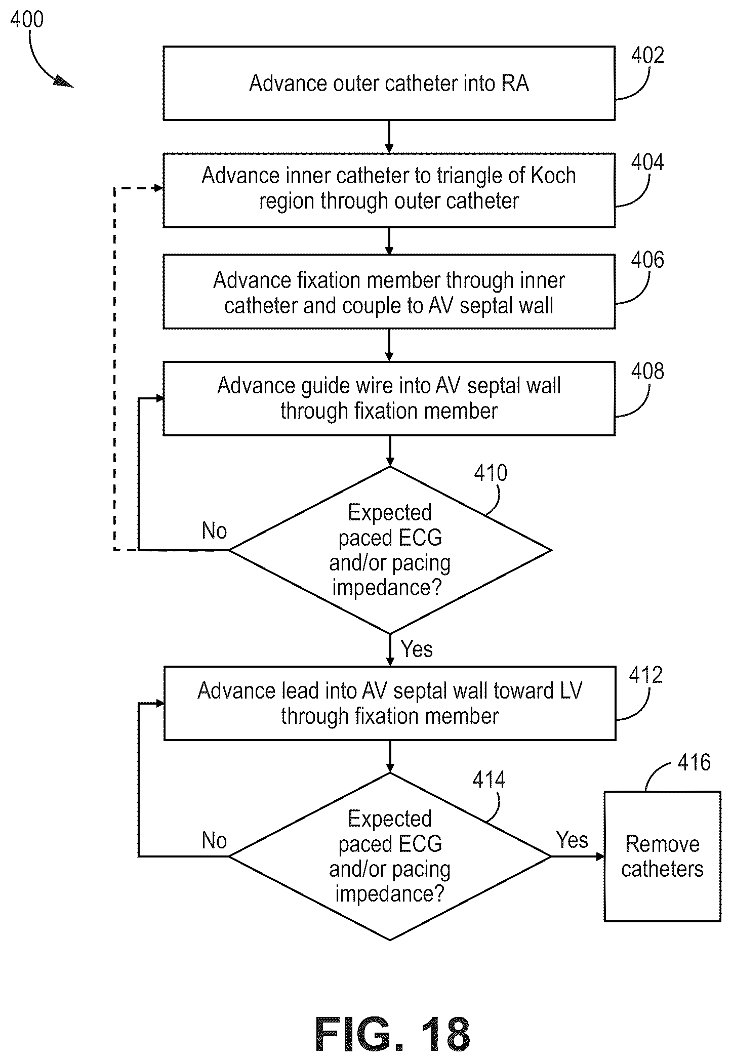 Patent US12569694 Figure 17 – Adjustable lead systems for cardiac septal wall implantation