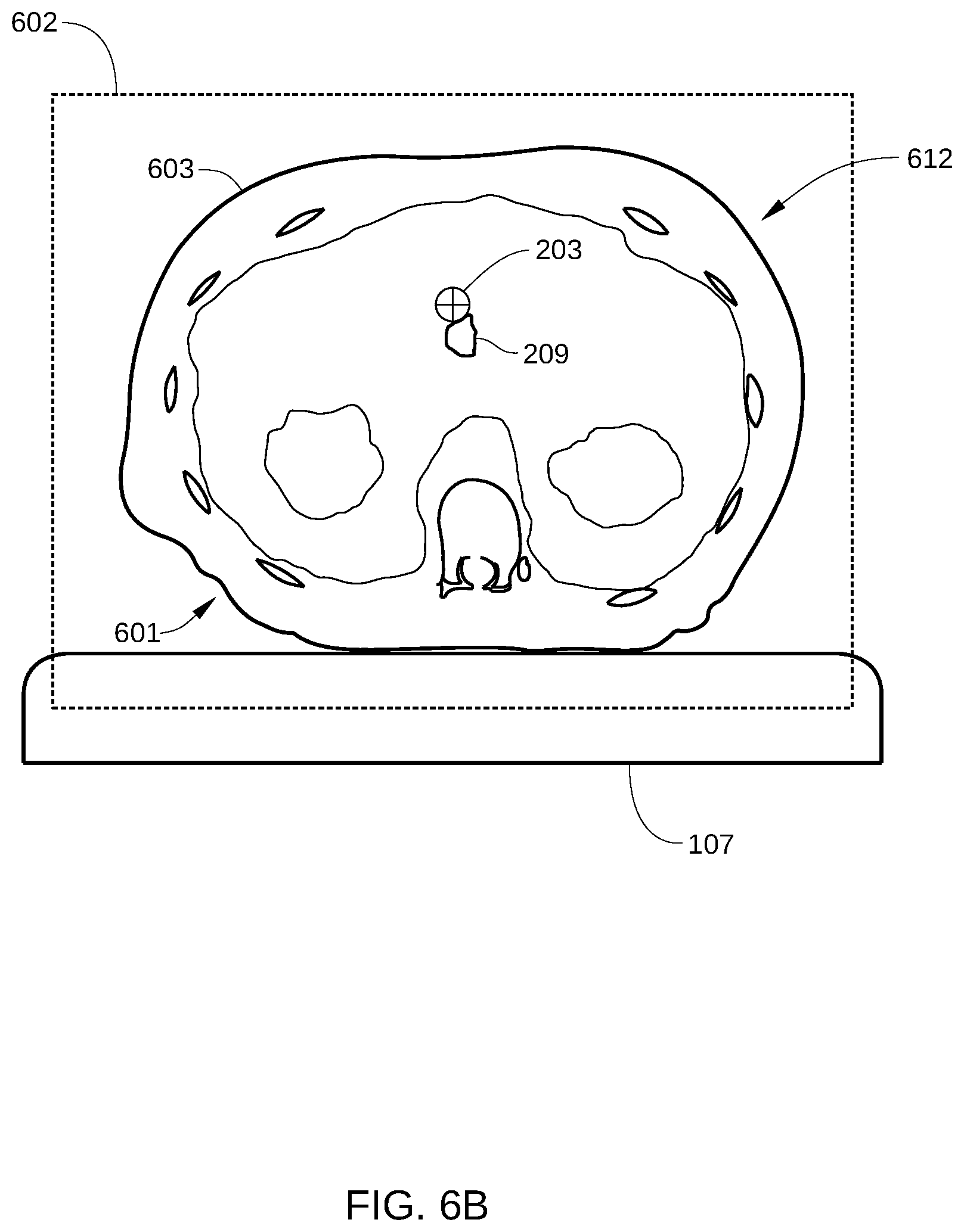 Patent US12569701 Figure 7 – Quality assurance for dosing in radiotherapy