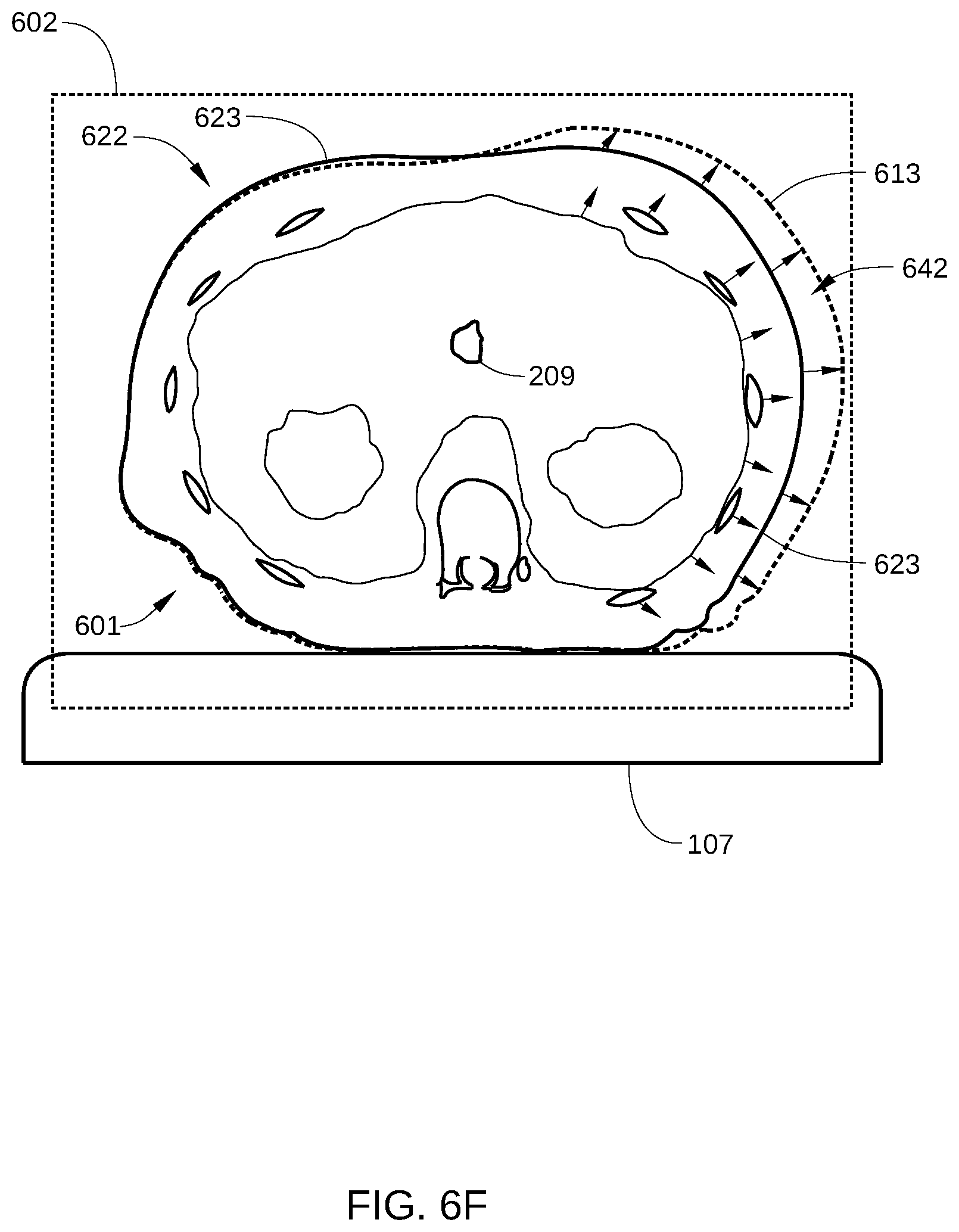 Patent US12569701 Figure 11 – Quality assurance for dosing in radiotherapy