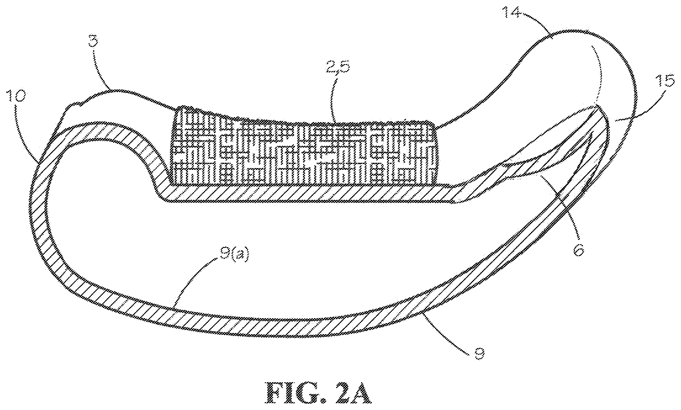 Patent US12569720 Figure 3 – Device and method for exercising and maintaining bladder and bowel control