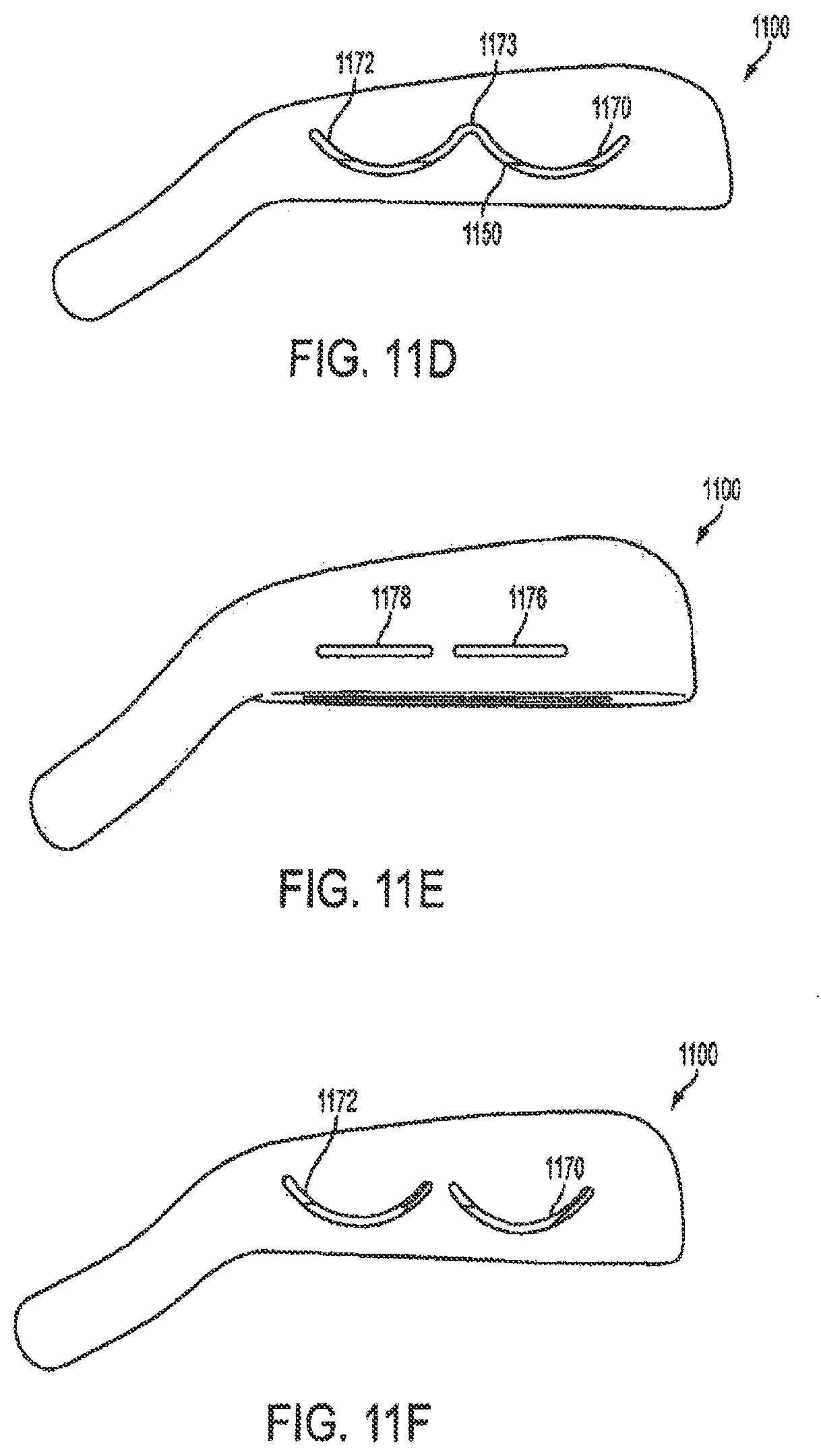 Patent US12569729 Figure 17 – Golf club