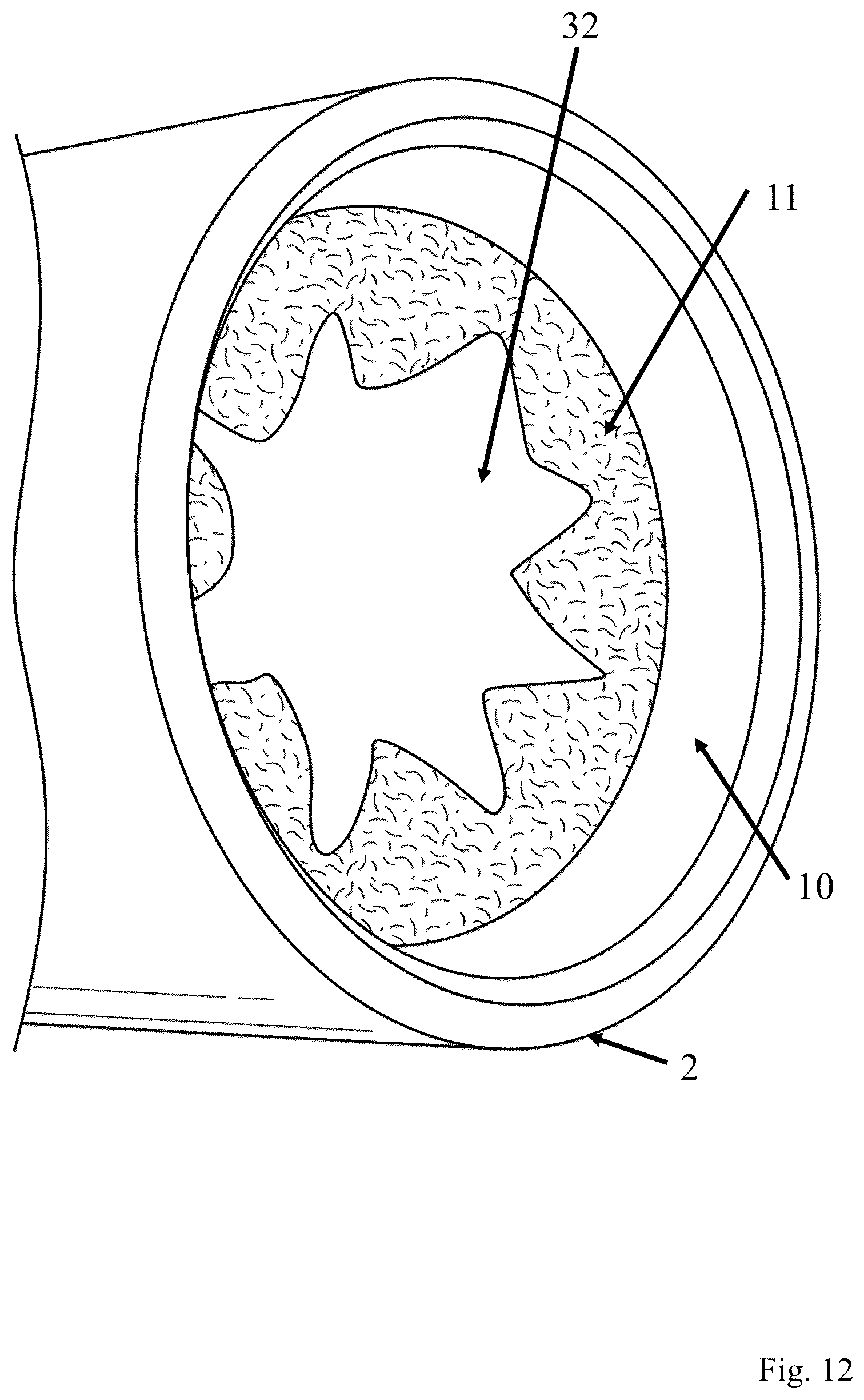 Patent US12569736 Figure 12 – Apparatus for storing a bat