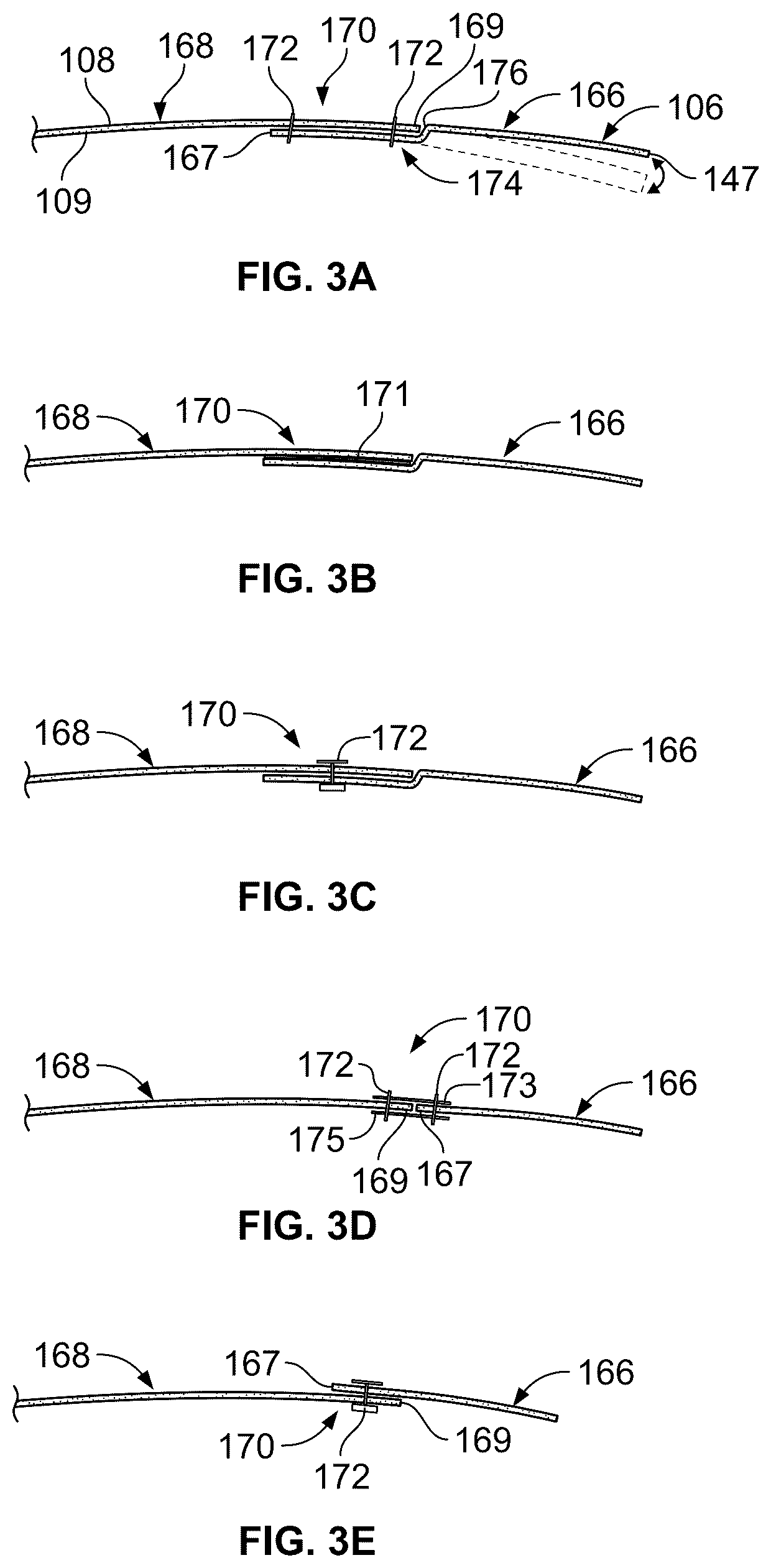 Patent US12569746 Figure 3 – Shoulder pad system with configurable cushion members