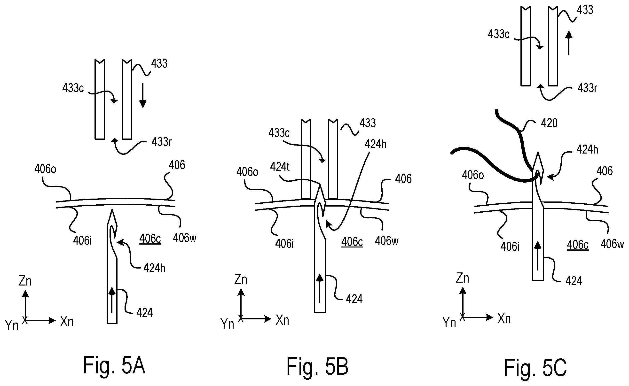 Patent US12569775 Figure 4 – Variable hair length apparatus for hair rooting