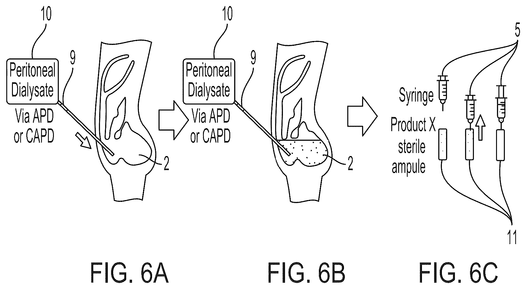 Patent US12569892 Figure 6 – Methods and compositions for decontaminating PD catheters
