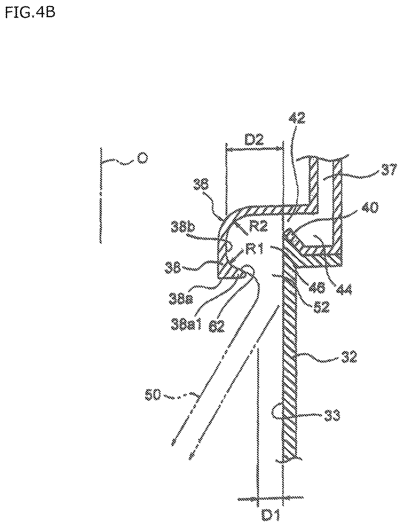 Patent US12569910 Figure 5 – Magnetic core, magnetic component and electronic device