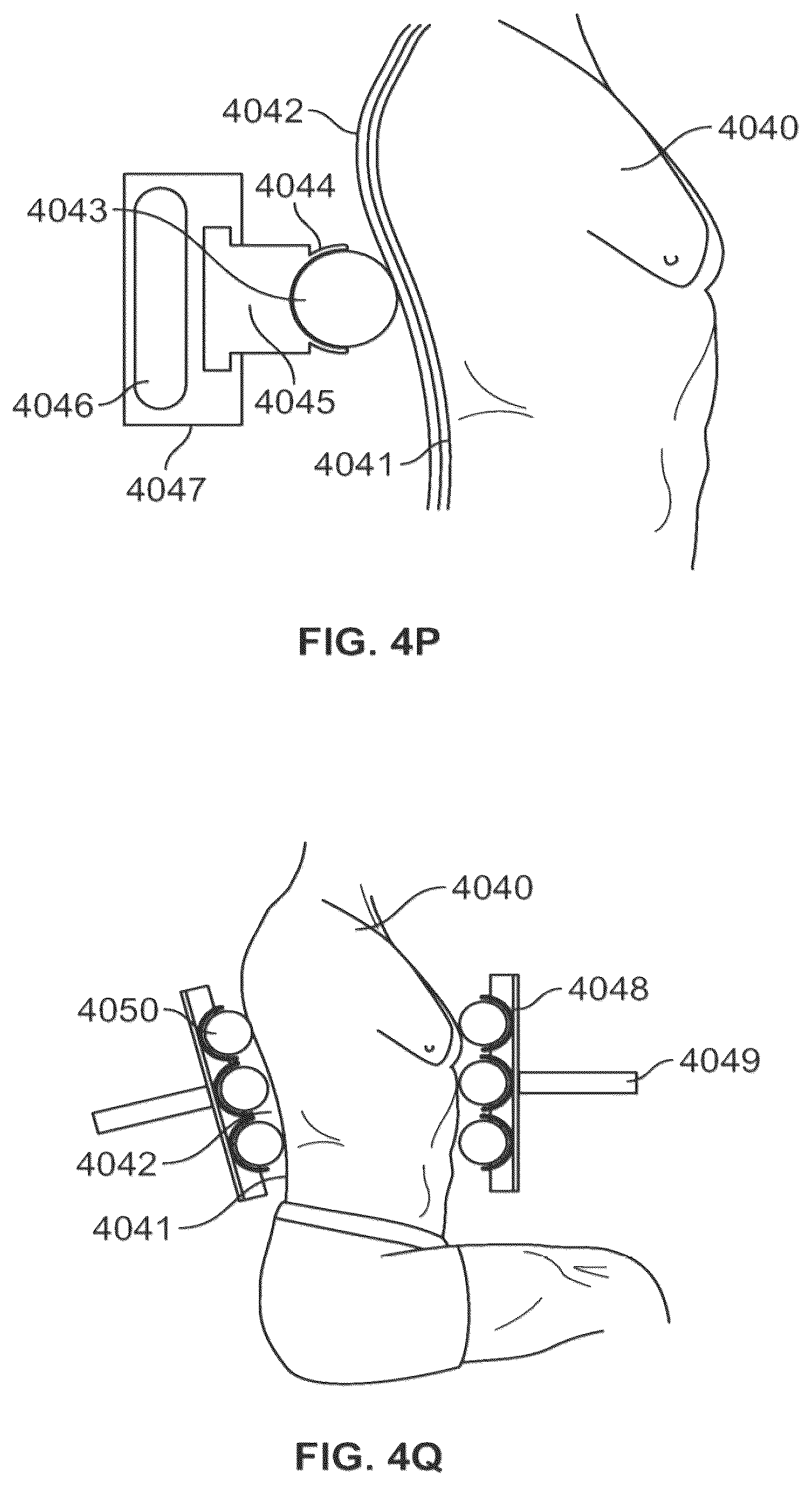 Patent US12576001 Figure 17 – Systems and methods to simulate hydrostatic force on a user with minimal shear force