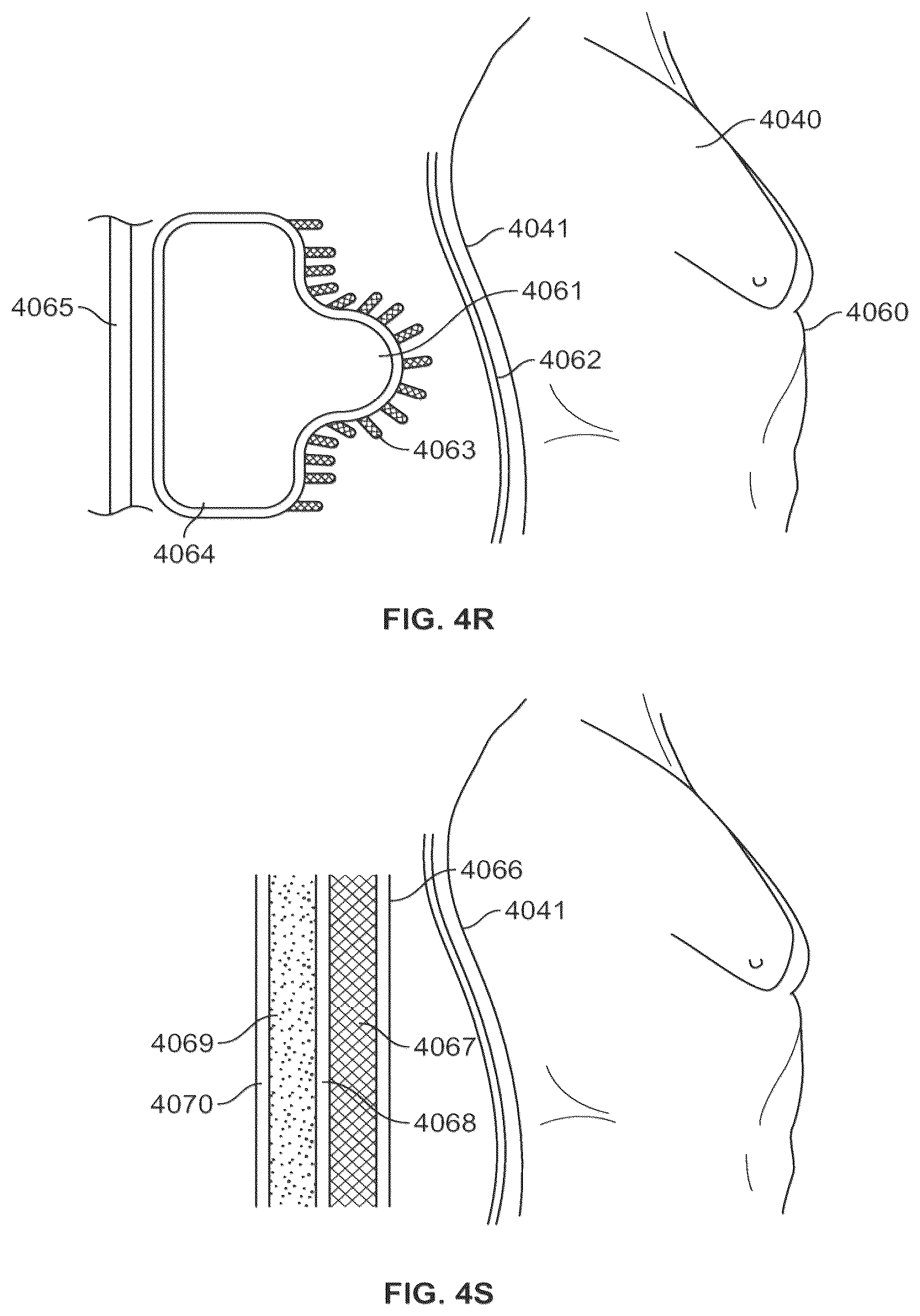Patent US12576001 Figure 18 – Systems and methods to simulate hydrostatic force on a user with minimal shear force