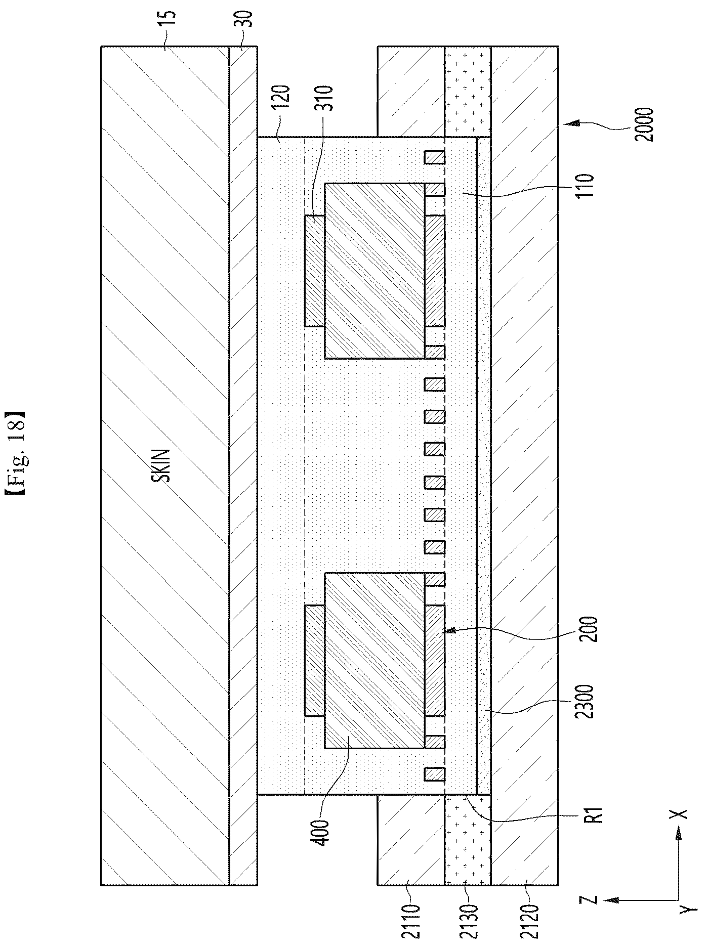 Patent US12576004 Figure 17 – Mask