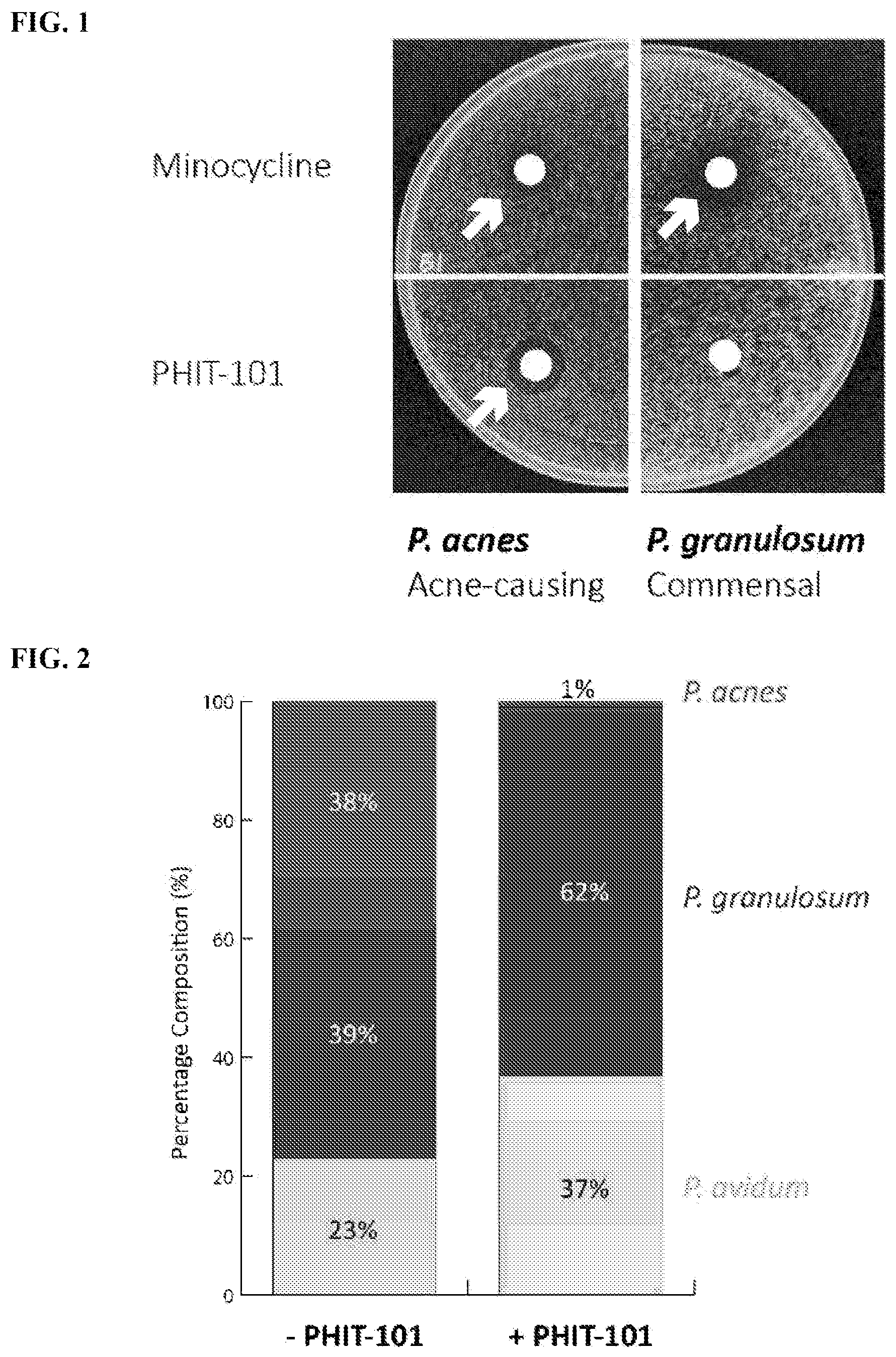 Patent US12576024 Figure 1 – Compositions comprising Propionibacterium acnes bacteriophages for treating acne