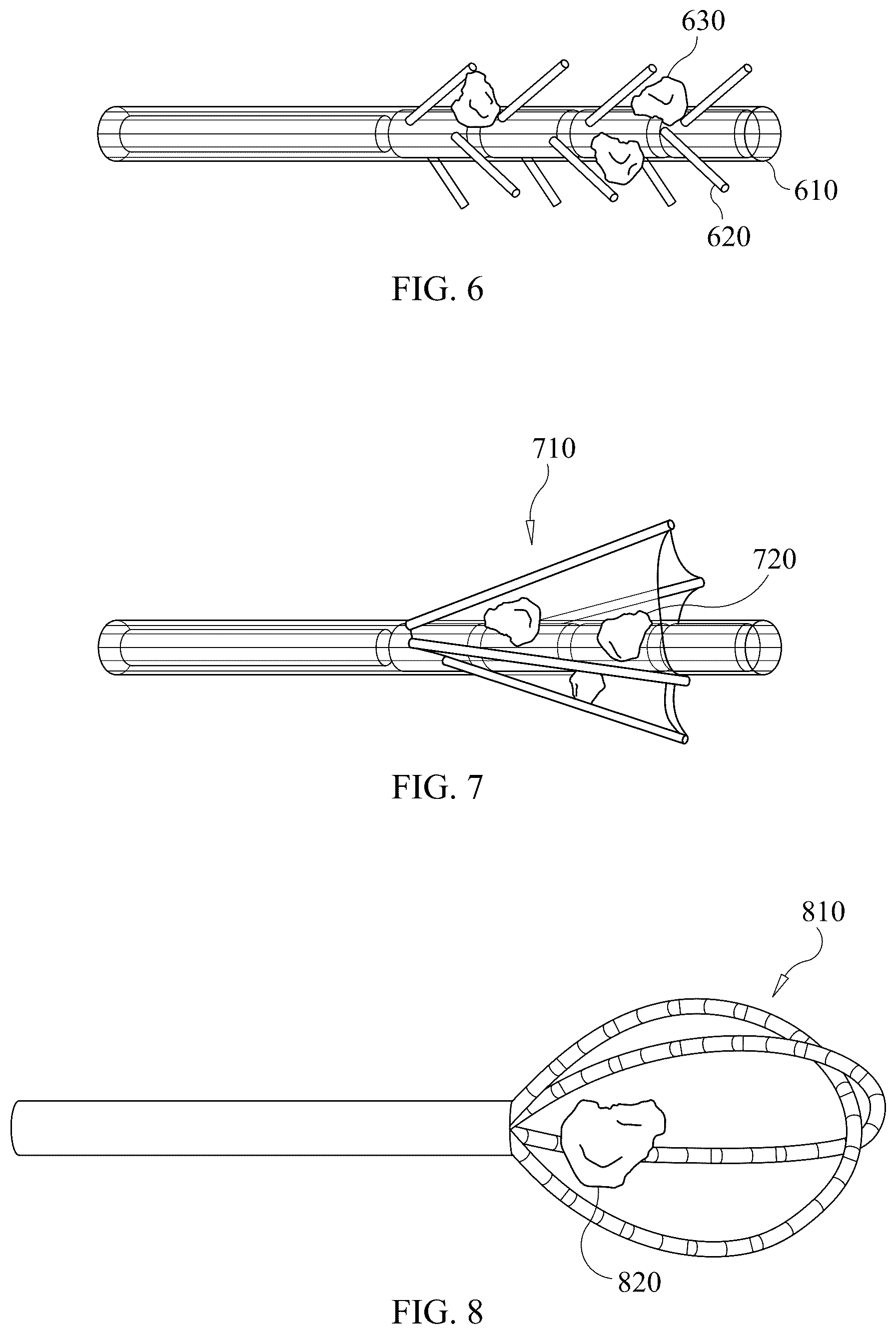 Patent US12576031 Figure 5 – Magnetic wire for retrieval and elimination of calculus from the urinary tract