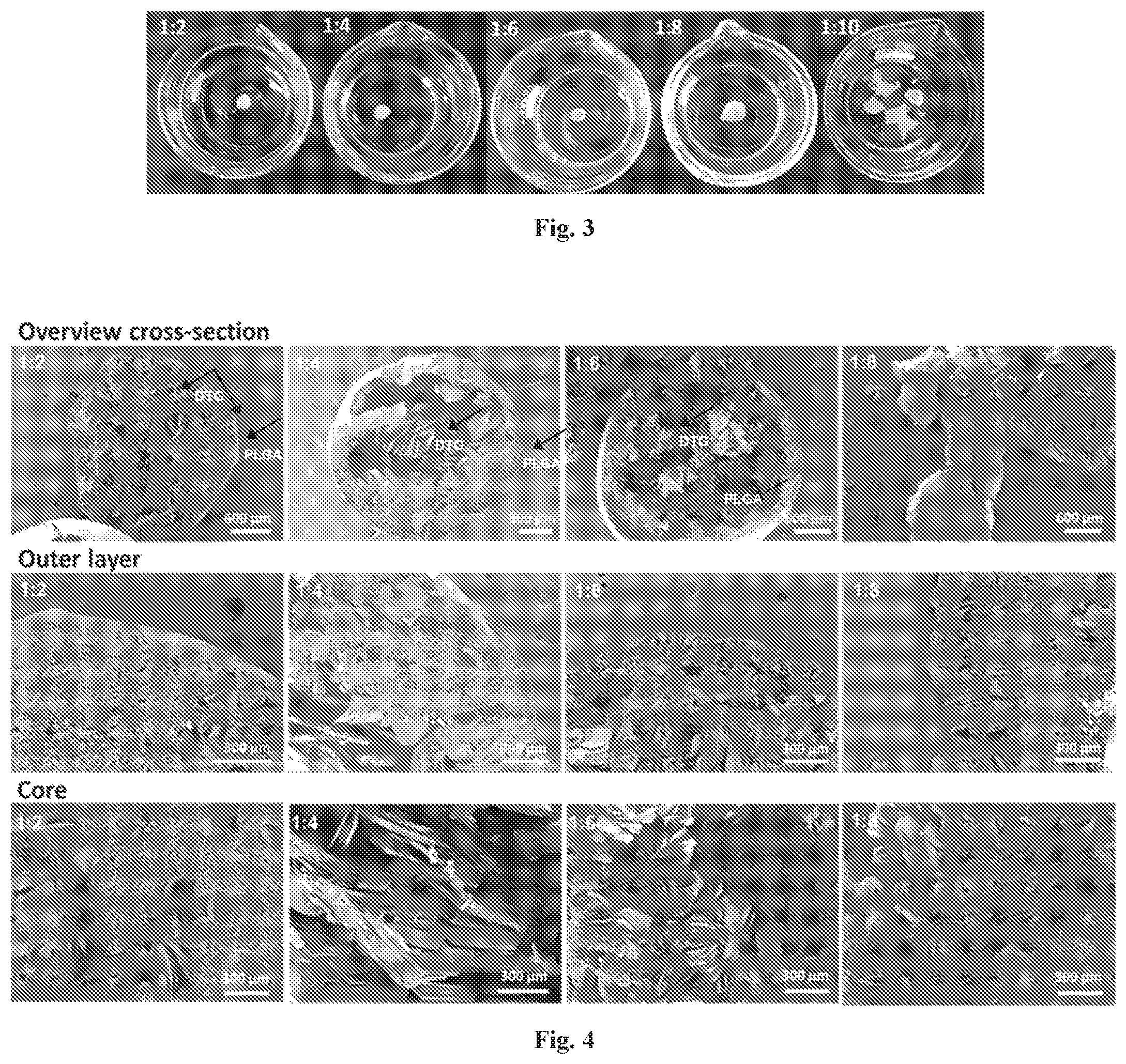Patent US12576035 Figure 4 – Polymeric implants with high drug loading and long-acting drug release and methods of making the same