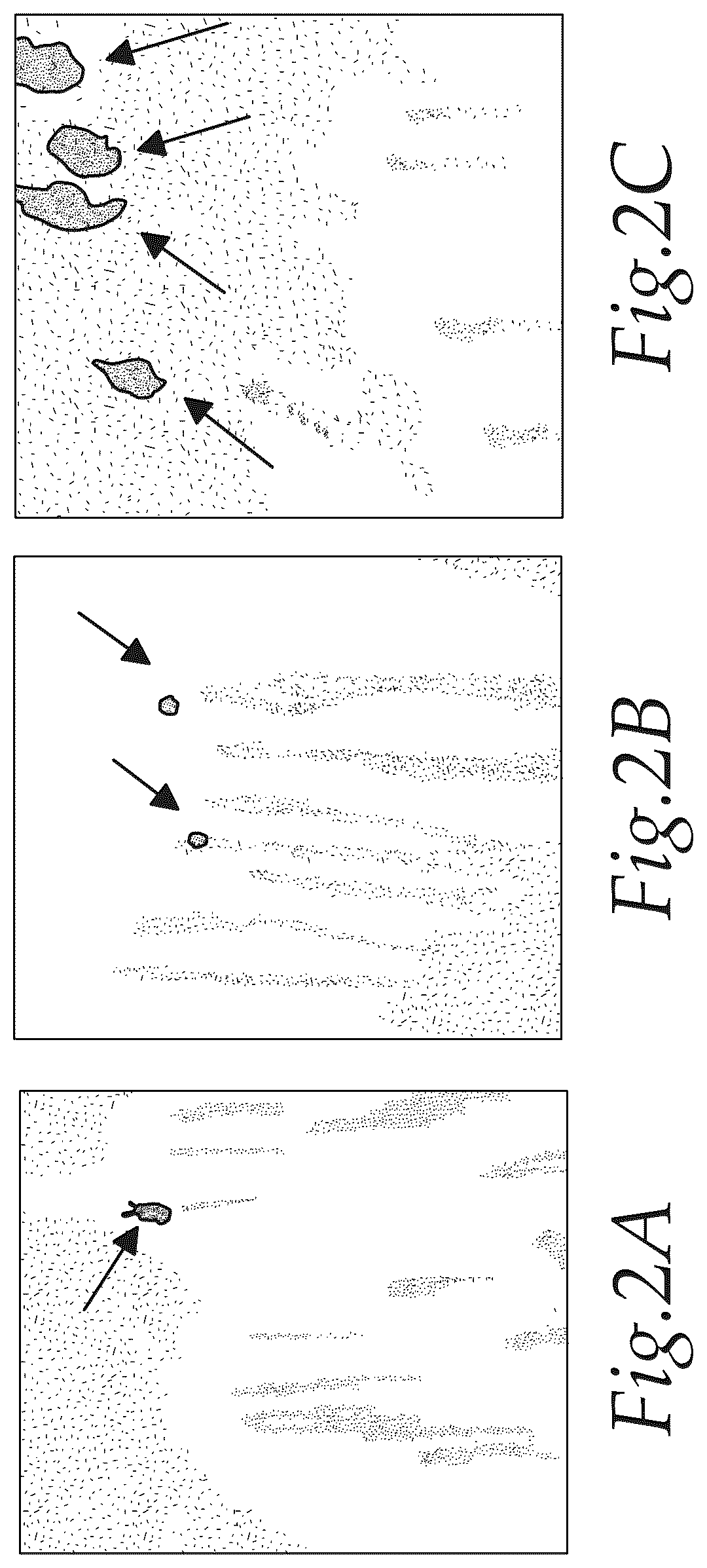 Patent US12576044 Figure 2 – Treatment of Alzheimer's disease