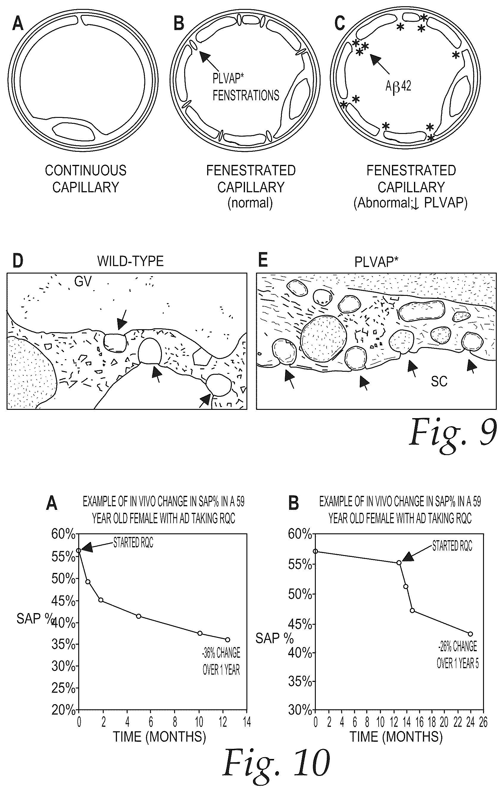 Patent US12576044 Figure 9 – Treatment of Alzheimer's disease