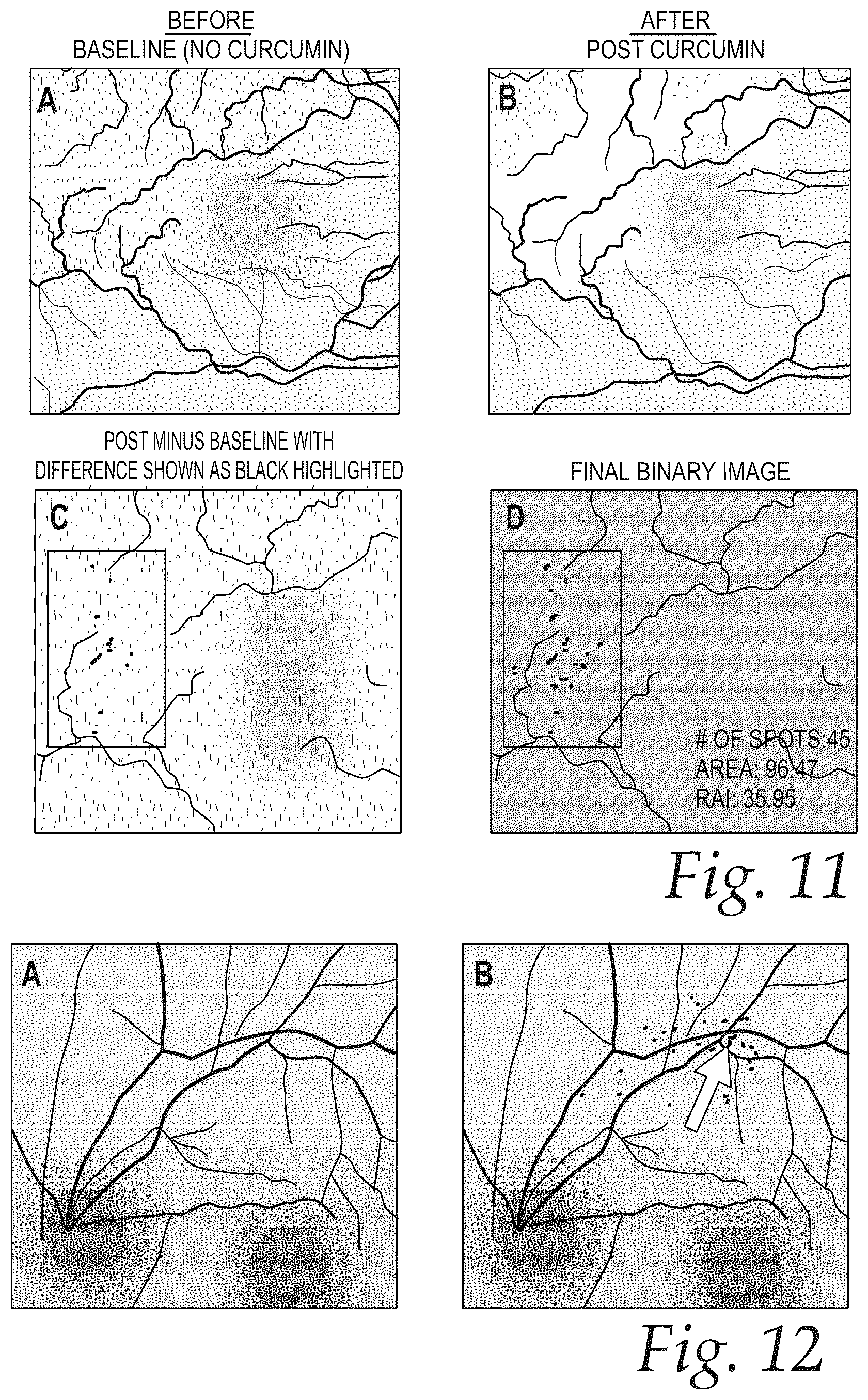 Patent US12576044 Figure 10 – Treatment of Alzheimer's disease