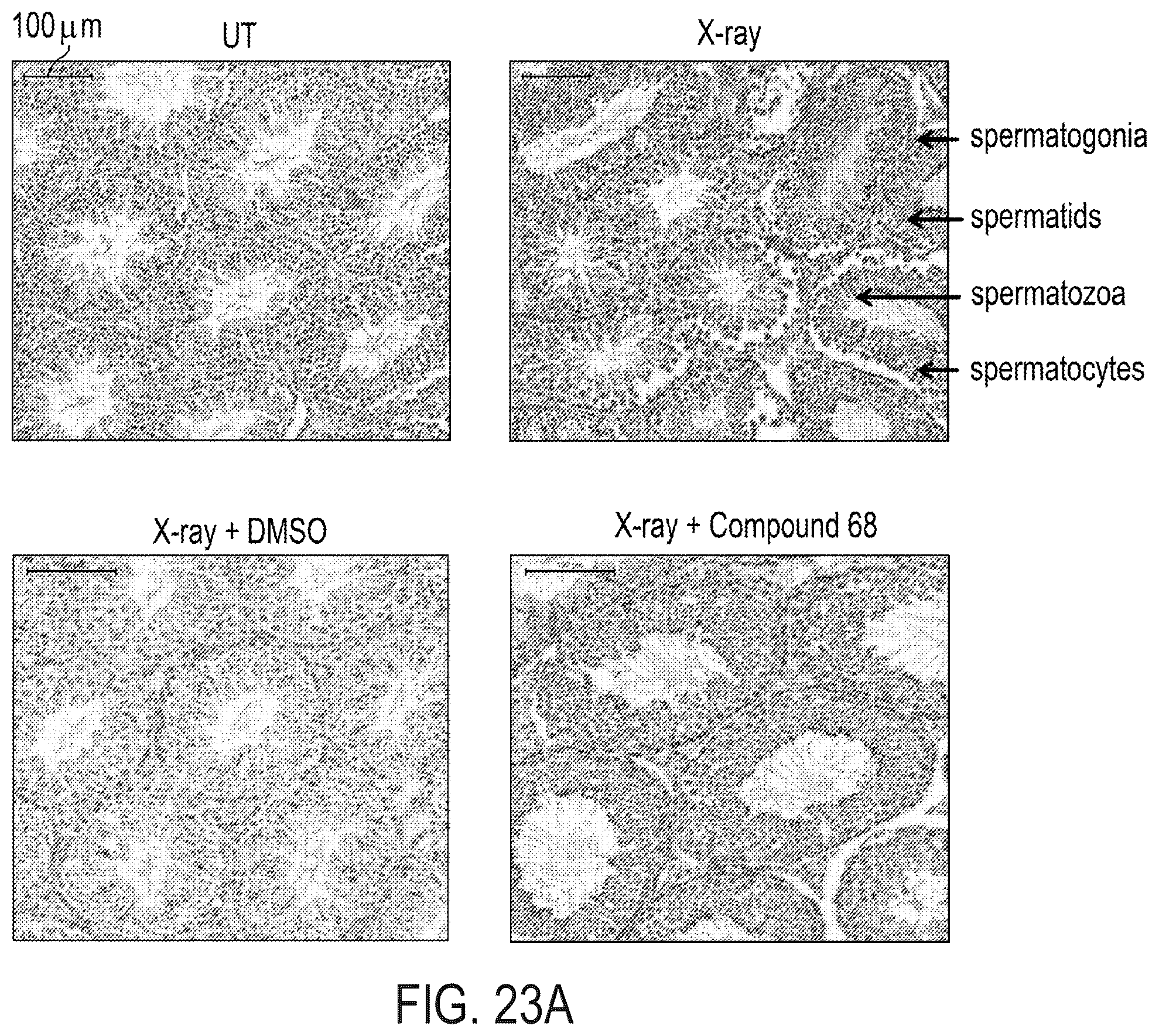 Patent US12576047 Figure 18 – Telomerase activating compounds for use in fertility and related applications