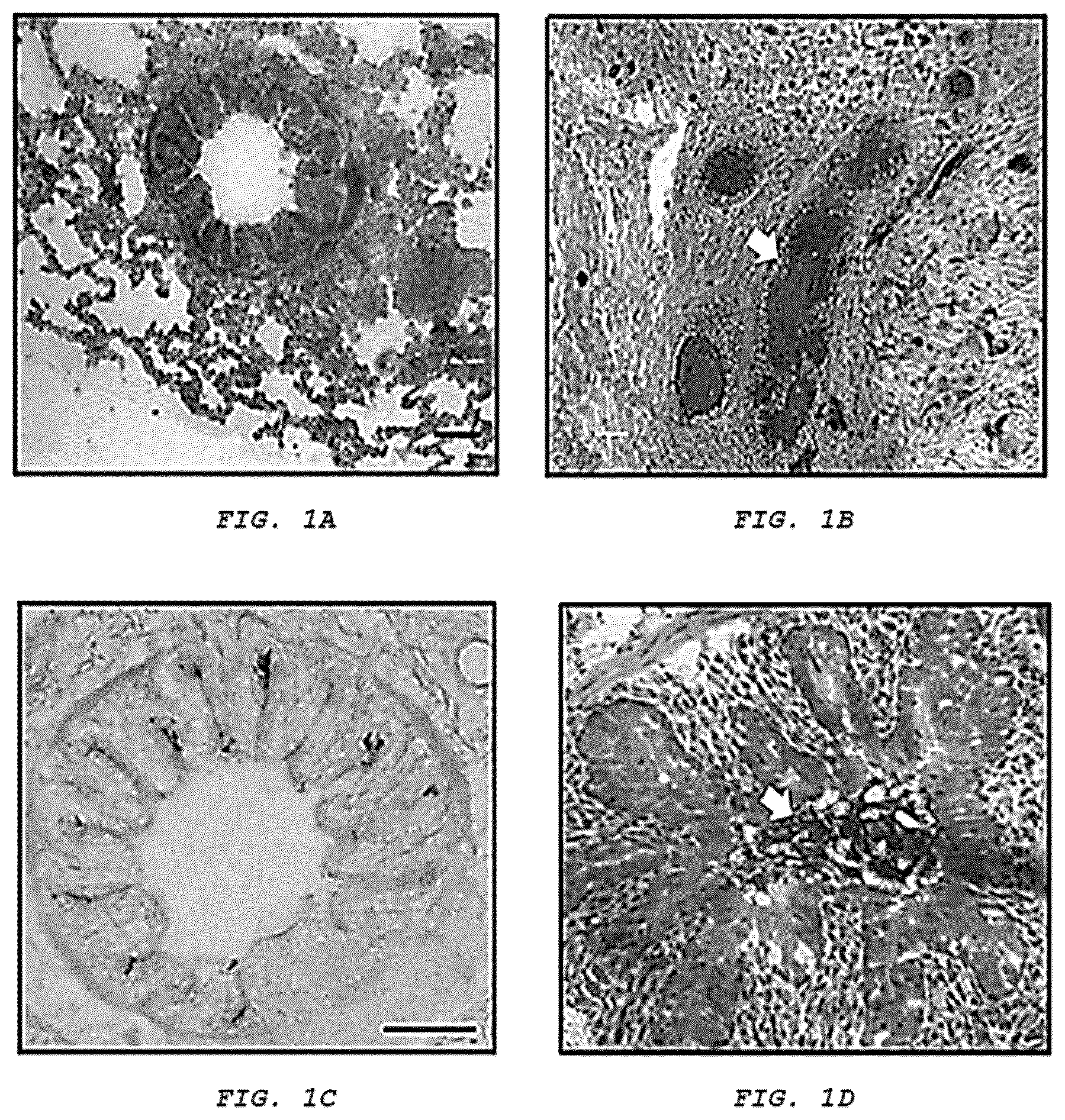 Patent US12576051 — Methods and composition for treating respiratory obstructive diseases — Figure 1