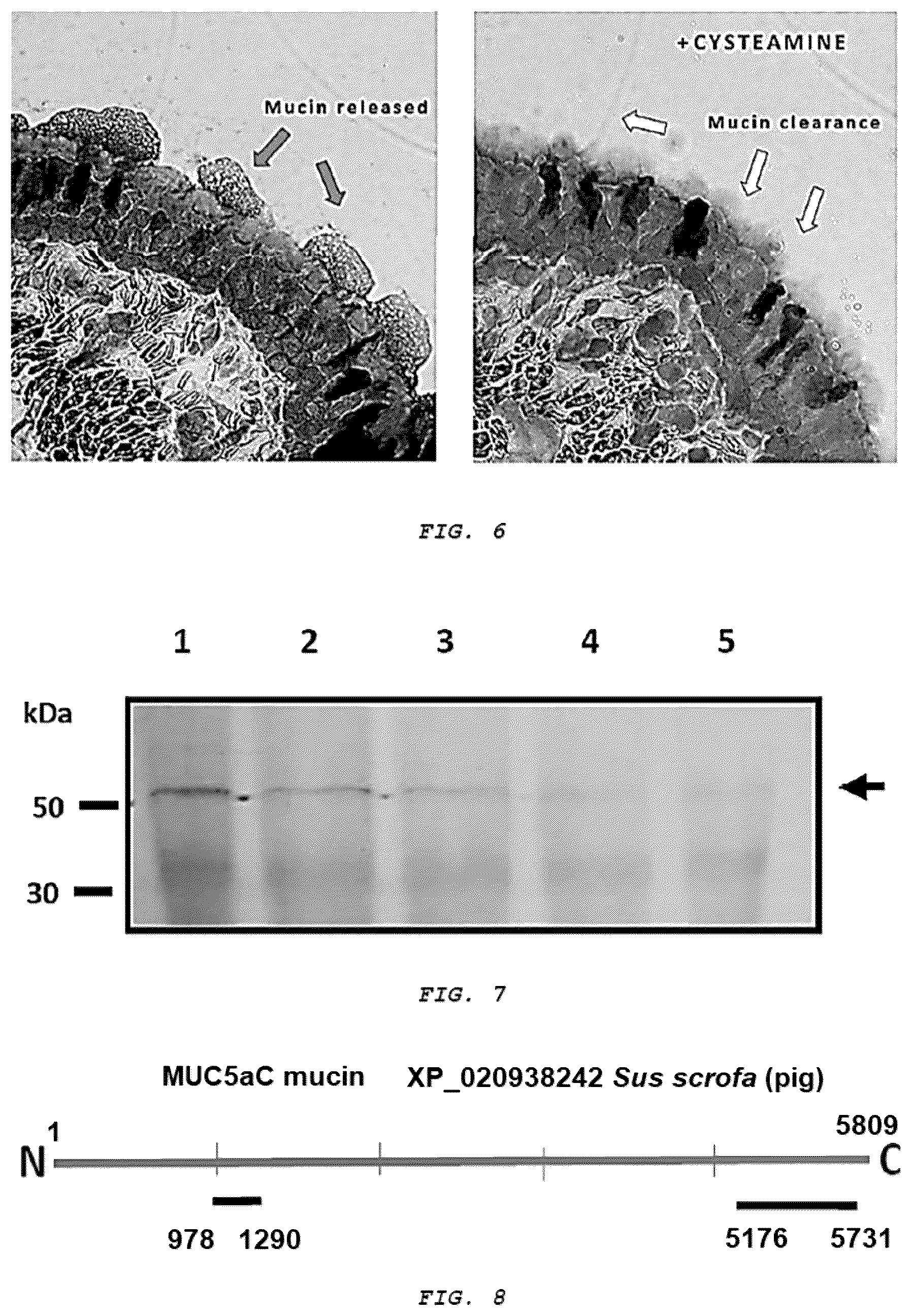 Patent US12576051 Figure 5 – Methods and composition for treating respiratory obstructive diseases