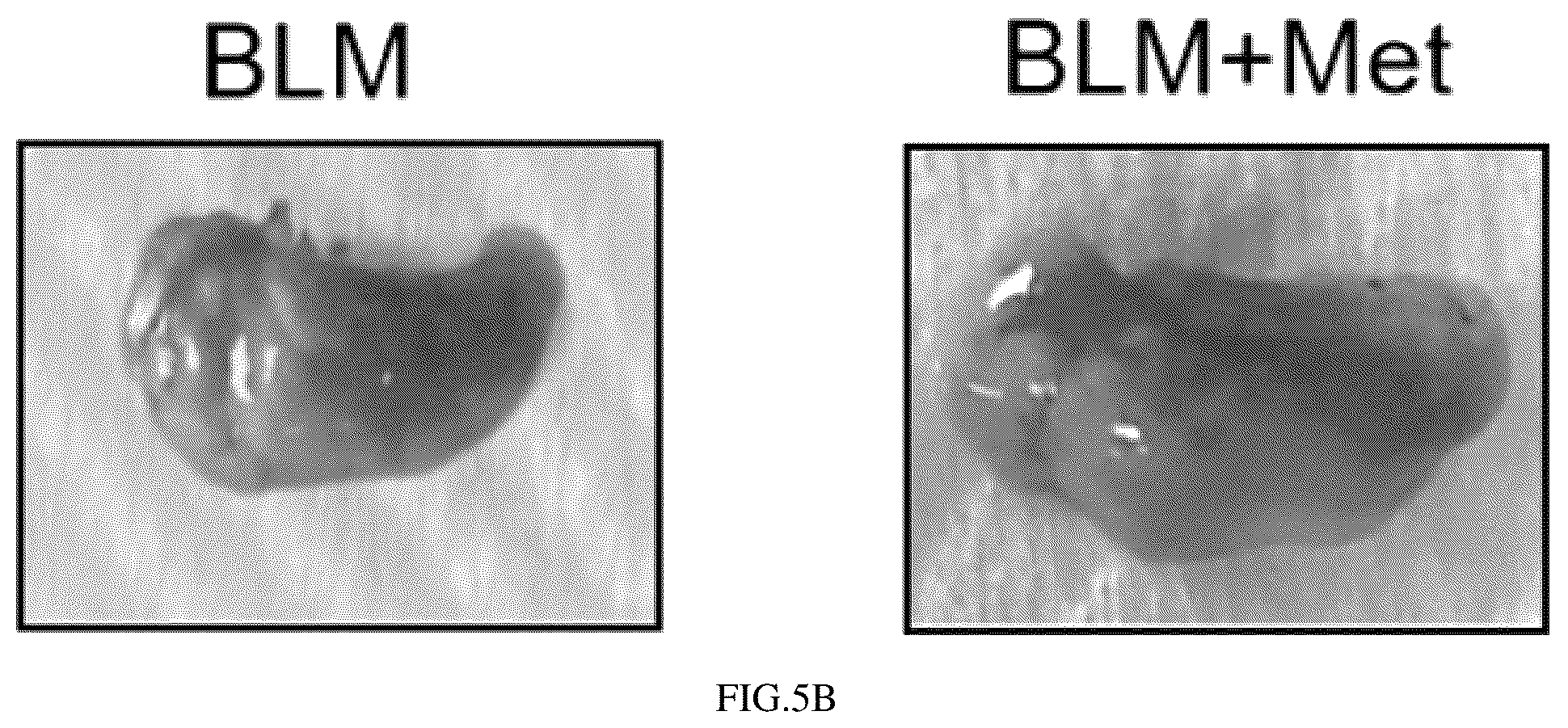 Patent US12576052 Figure 6 – Metformin inhalation powder aerosol for treating idiopathic pulmonary fibrosis and preparation method thereof