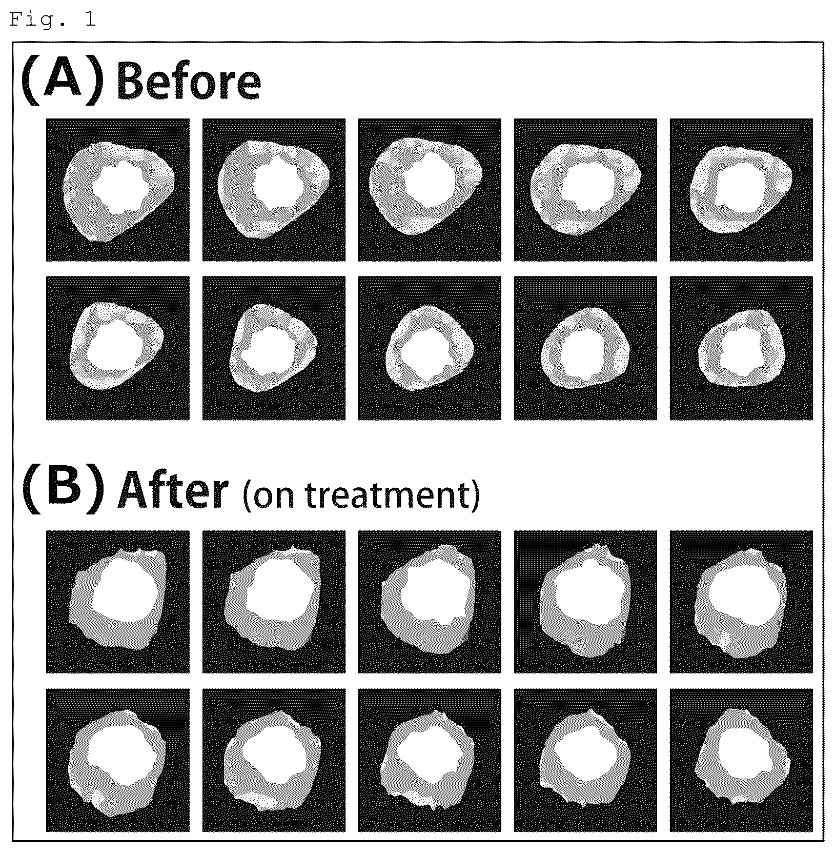Patent US12576061 — Agent for inducing regression of triglyceride deposit atherosclerosis — Figure 1