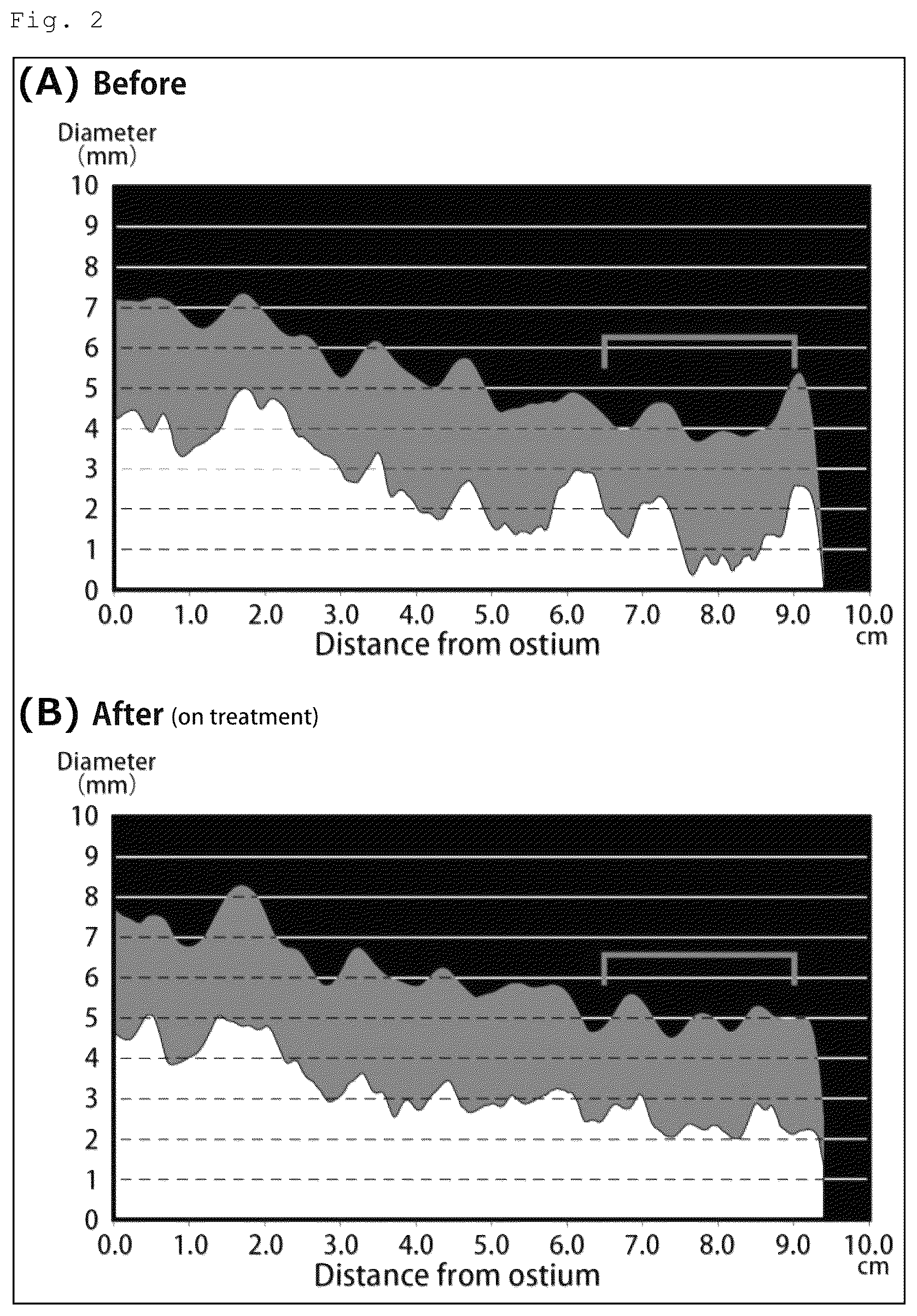 Patent US12576061 Figure 2 – Agent for inducing regression of triglyceride deposit atherosclerosis