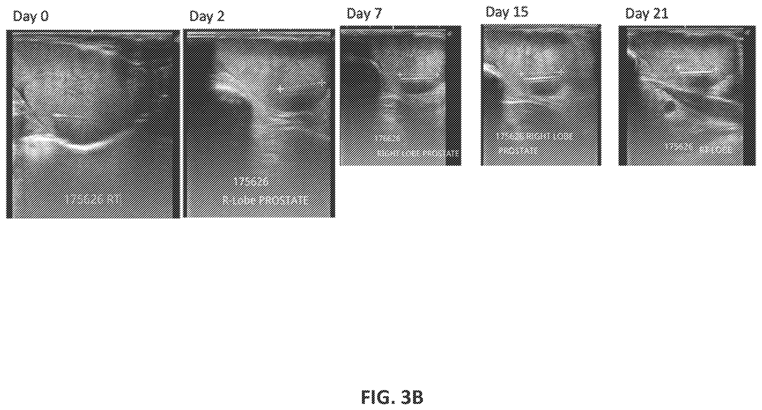 Patent US12576063 Figure 9 – Implantable drug delivery devices for localized drug delivery