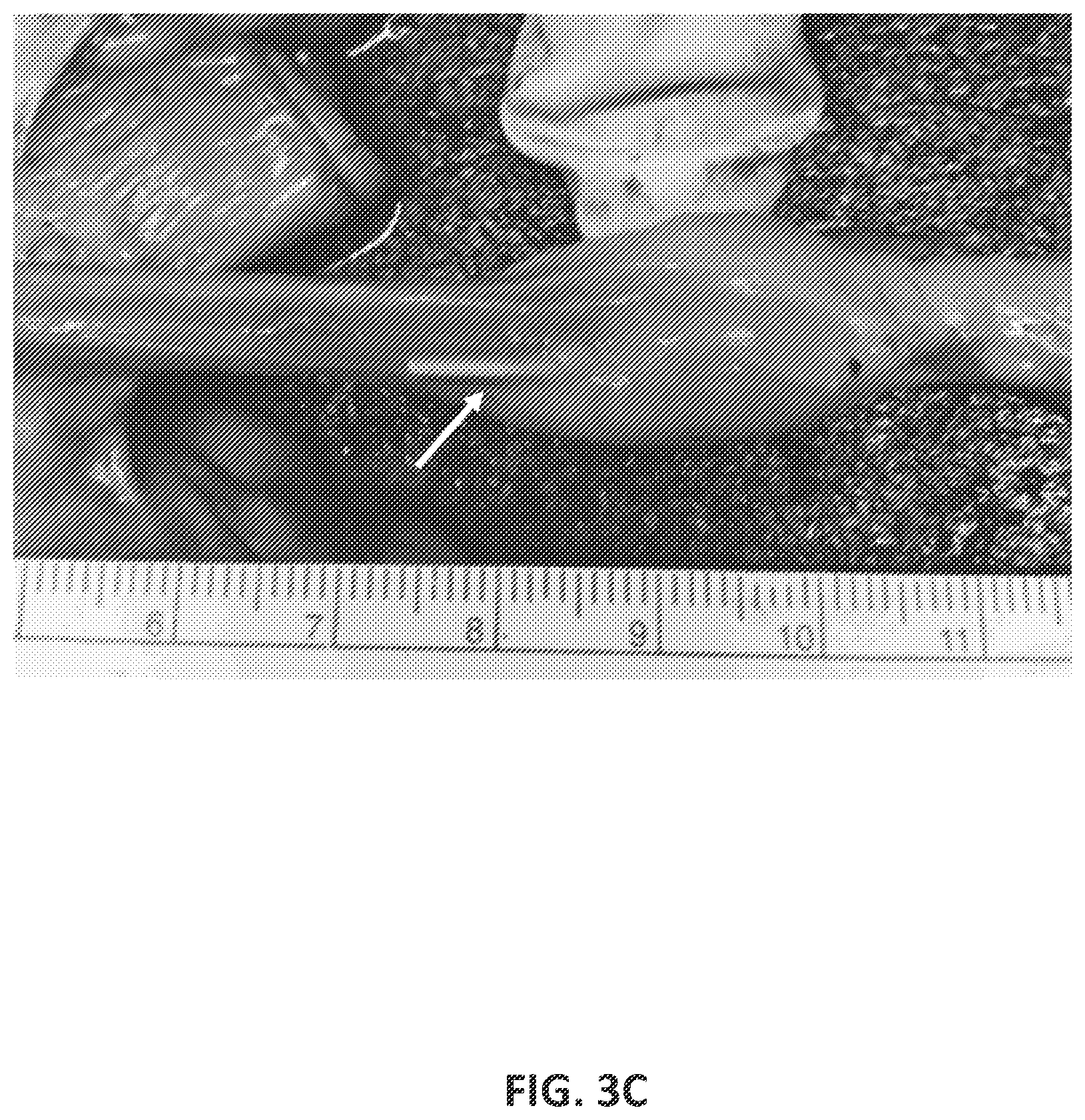 Patent US12576063 Figure 10 – Implantable drug delivery devices for localized drug delivery