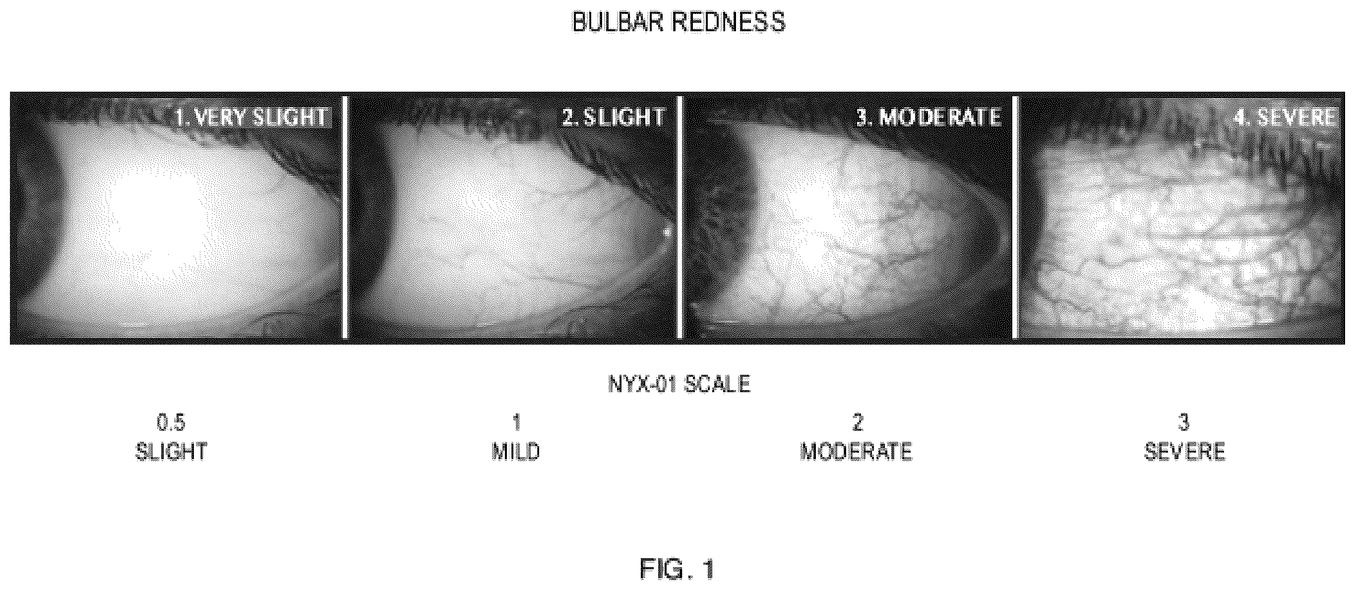 Patent US12576066 Figure 1 – Methods and compositions for treatment of mydriasis