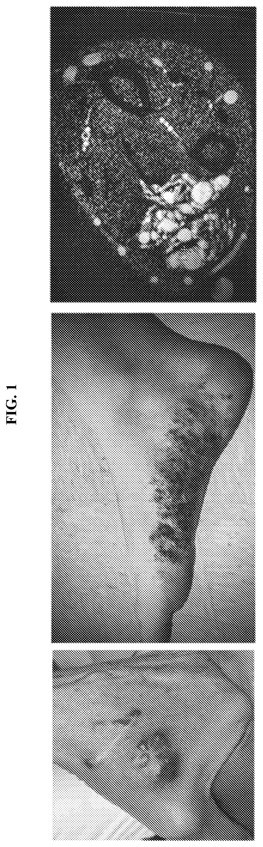 Patent US12576069 Figure 1 – Compositions and methods for treating slow-flow vascular malformations