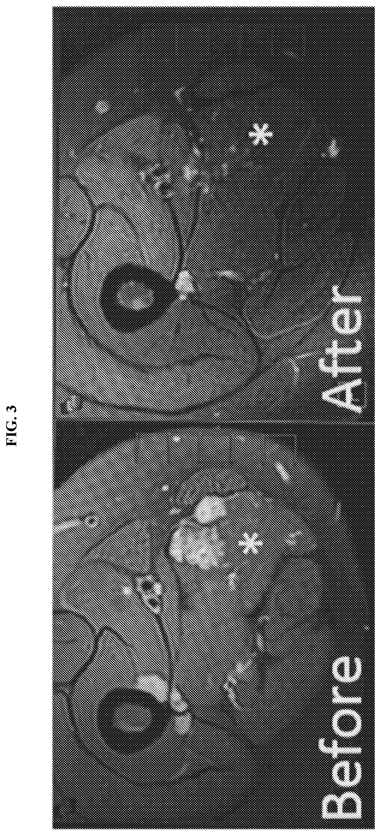 Patent US12576069 Figure 3 – Compositions and methods for treating slow-flow vascular malformations