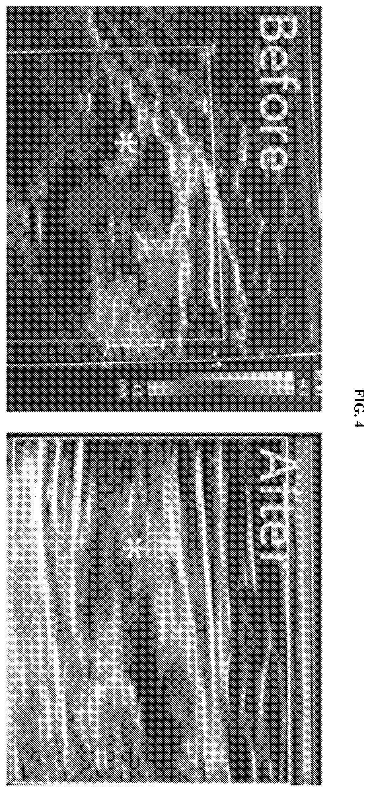 Patent US12576069 Figure 4 – Compositions and methods for treating slow-flow vascular malformations