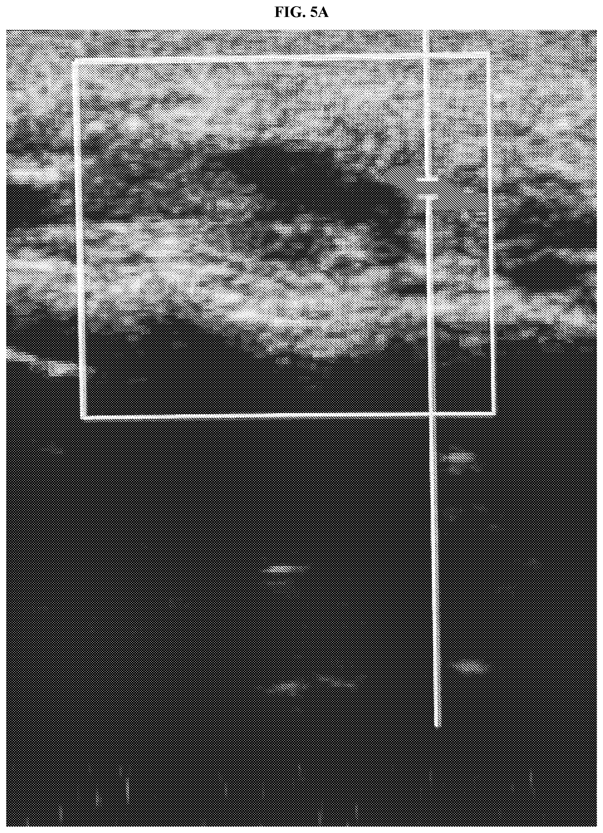 Patent US12576069 Figure 5 – Compositions and methods for treating slow-flow vascular malformations