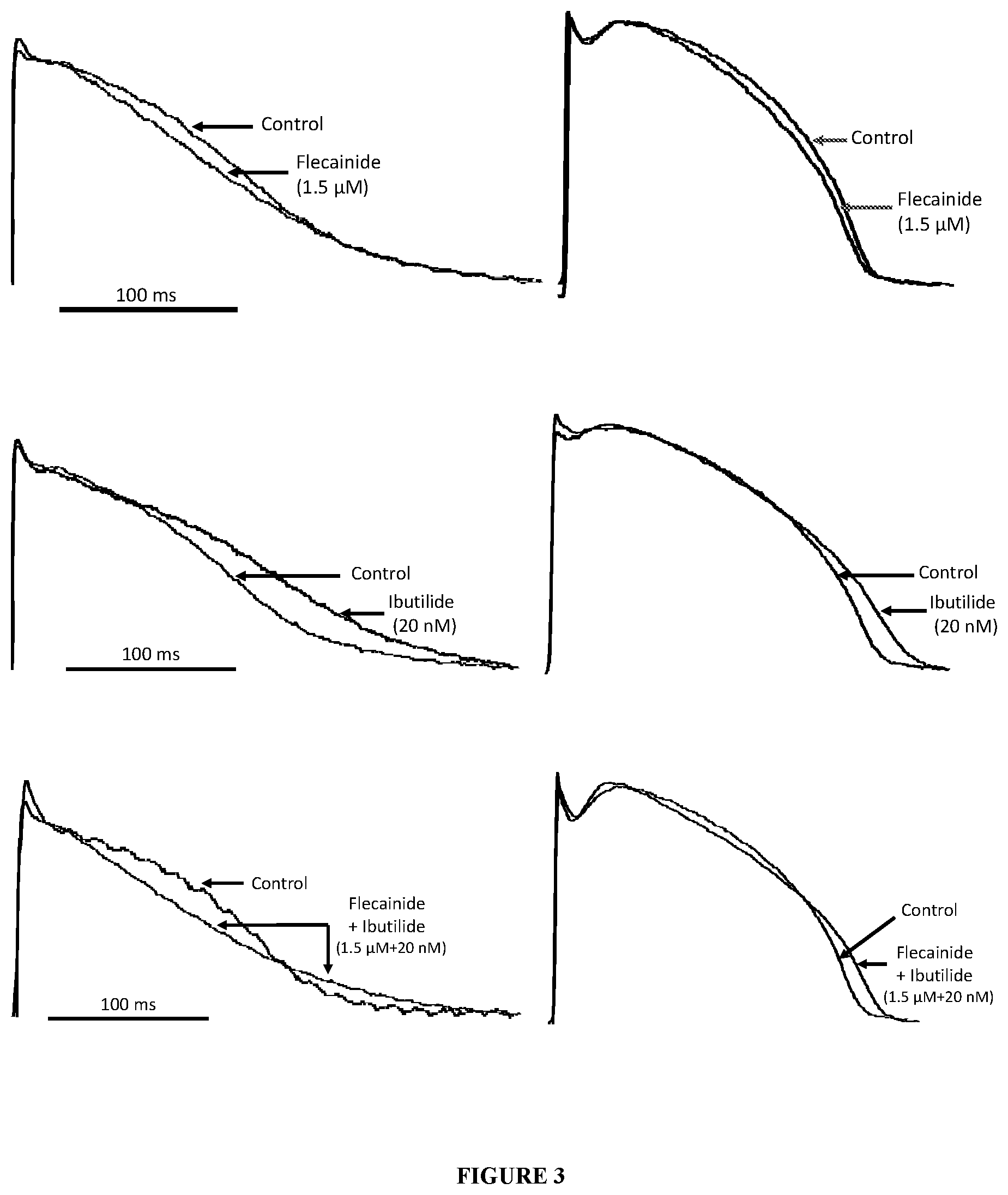 Patent US12576074 Figure 3 – Kits and methods for induction of cardioversion in subjects with atrial arrhythmias