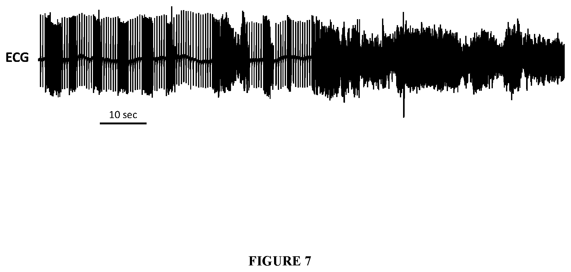 Patent US12576074 Figure 7 – Kits and methods for induction of cardioversion in subjects with atrial arrhythmias