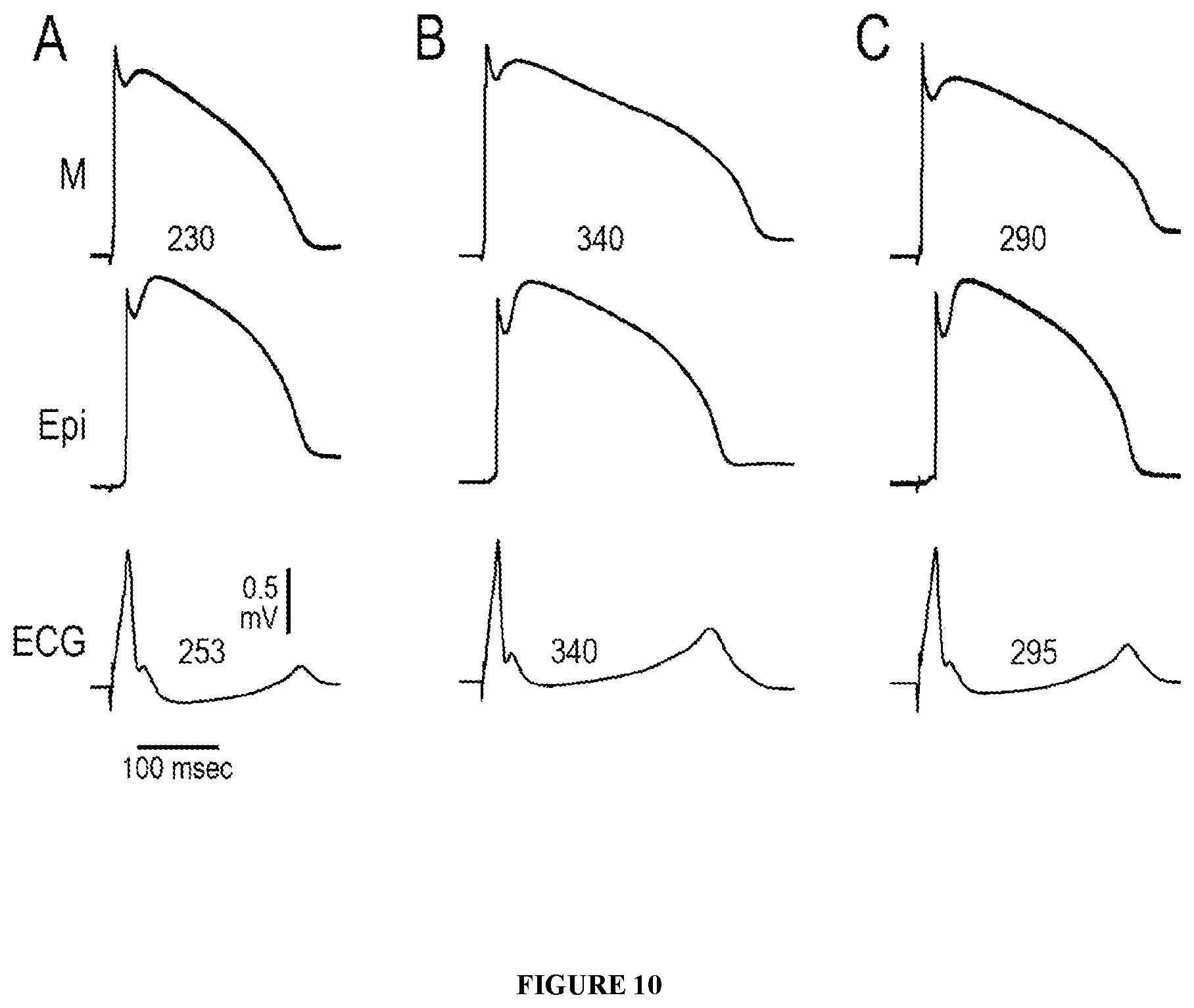 Patent US12576074 Figure 10 – Kits and methods for induction of cardioversion in subjects with atrial arrhythmias