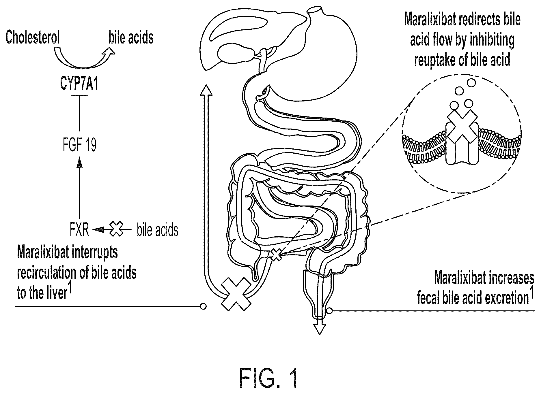 Patent US12576079 Figure 1 – Methods for treating cholestasis