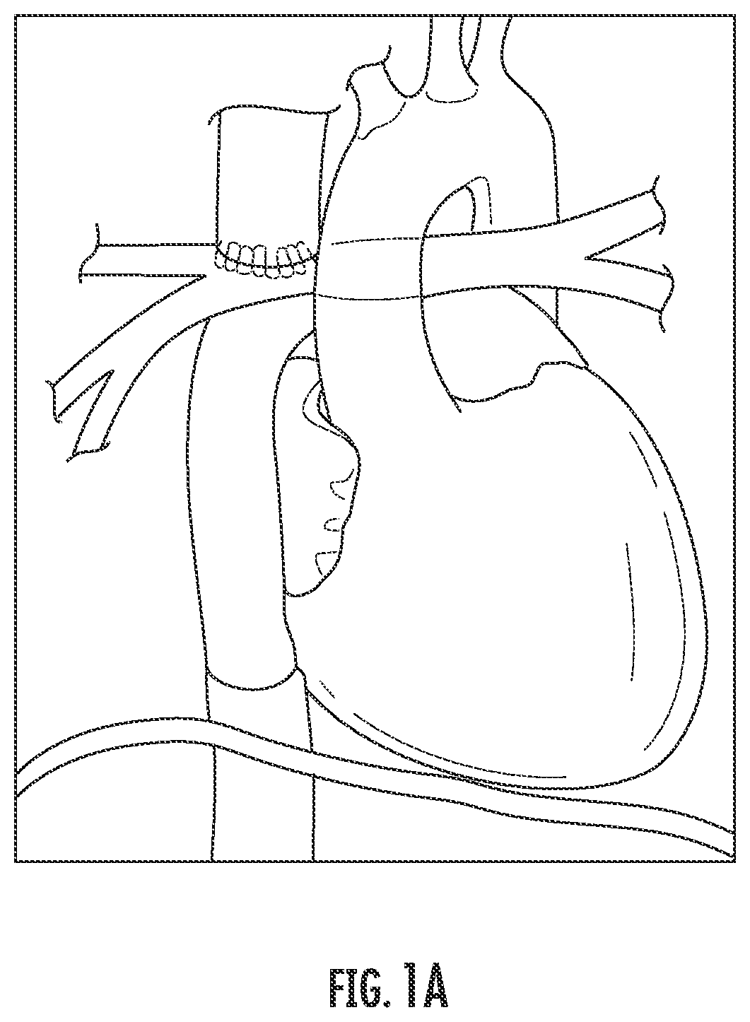 Patent US12576081 — Methods and compositions for improving exercise performance, single ventricular performance, cardiac output and myocardial performance index (MPI) in single ventricular heart disease, using udenafil compositions — Figure 1