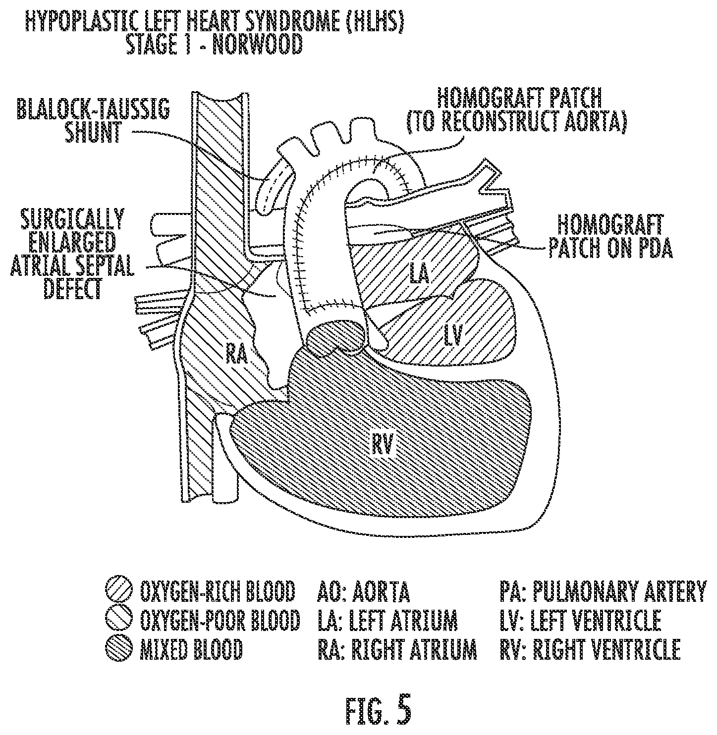 Patent US12576081 Figure 9 – Methods and compositions for improving exercise performance, single ventricular performance, cardiac output and myocardial performance index (MPI) in single ventricular heart disease, using udenafil compositions