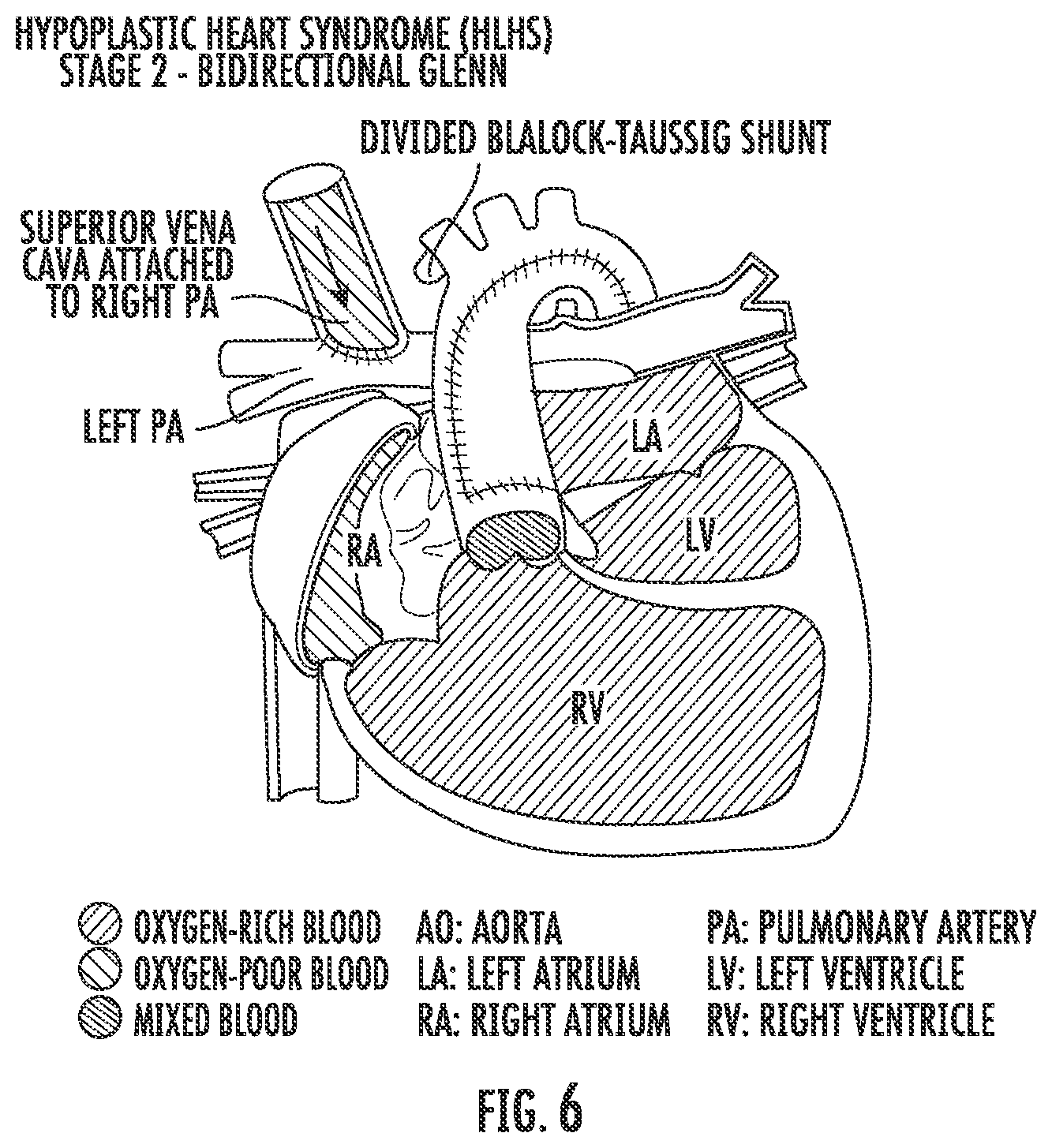 Patent US12576081 Figure 10 – Methods and compositions for improving exercise performance, single ventricular performance, cardiac output and myocardial performance index (MPI) in single ventricular heart disease, using udenafil compositions