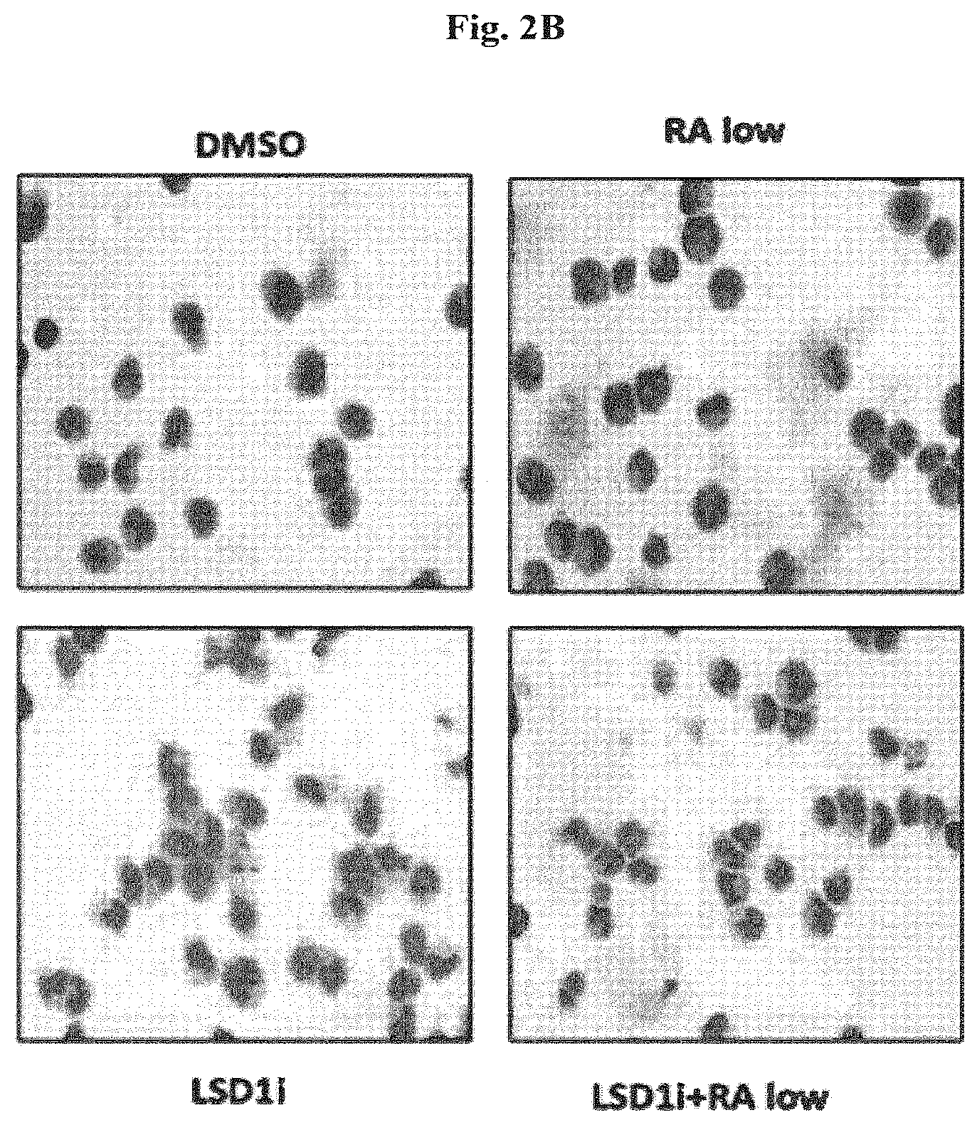 Patent US12576083 Figure 4 – Combinational therapy of LSD1 inhibitors with P21 activators in the treatment of cancer
