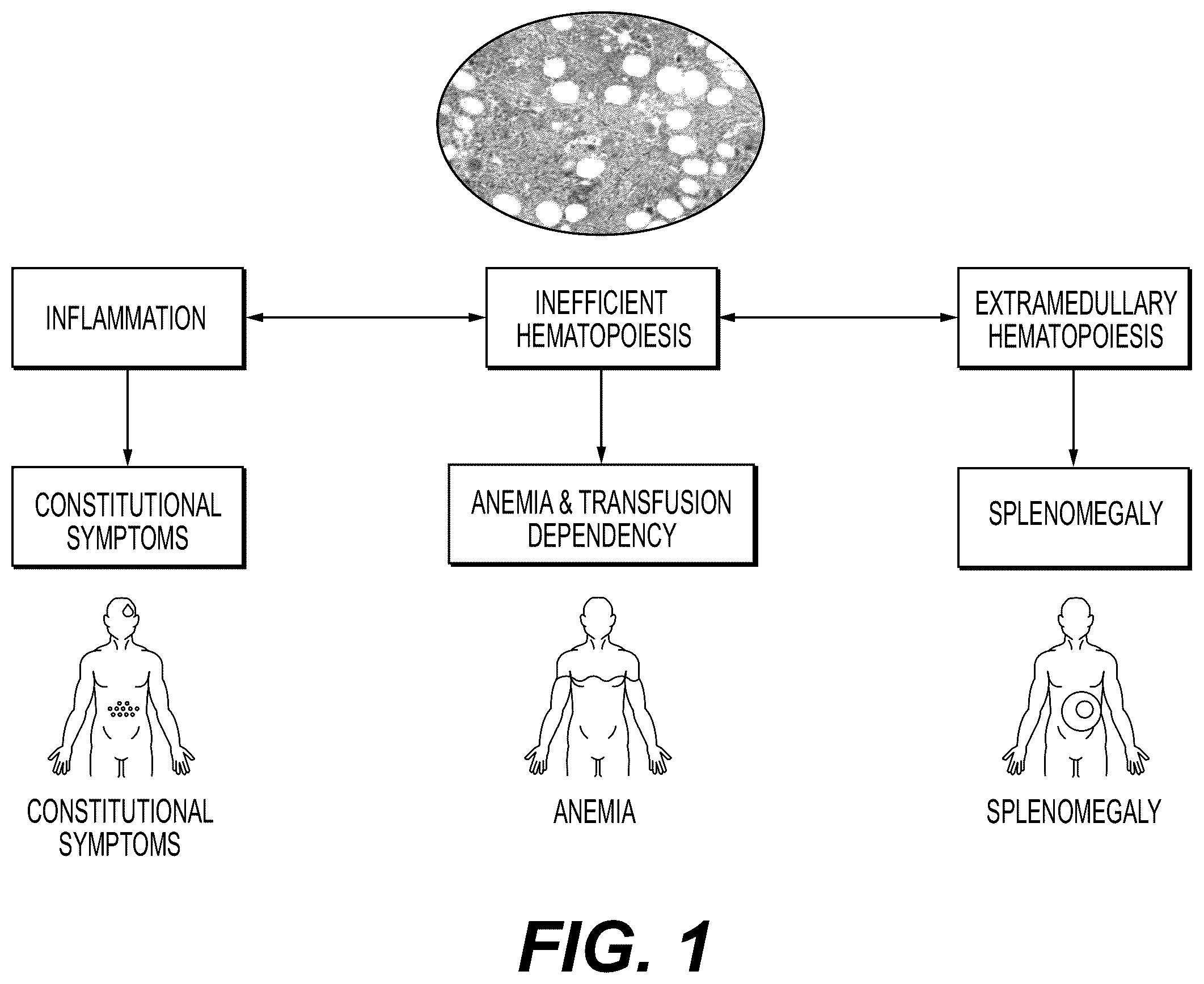 Patent US12576089 Figure 1 – Platelet count-agnostic methods of treating myelofibrosis