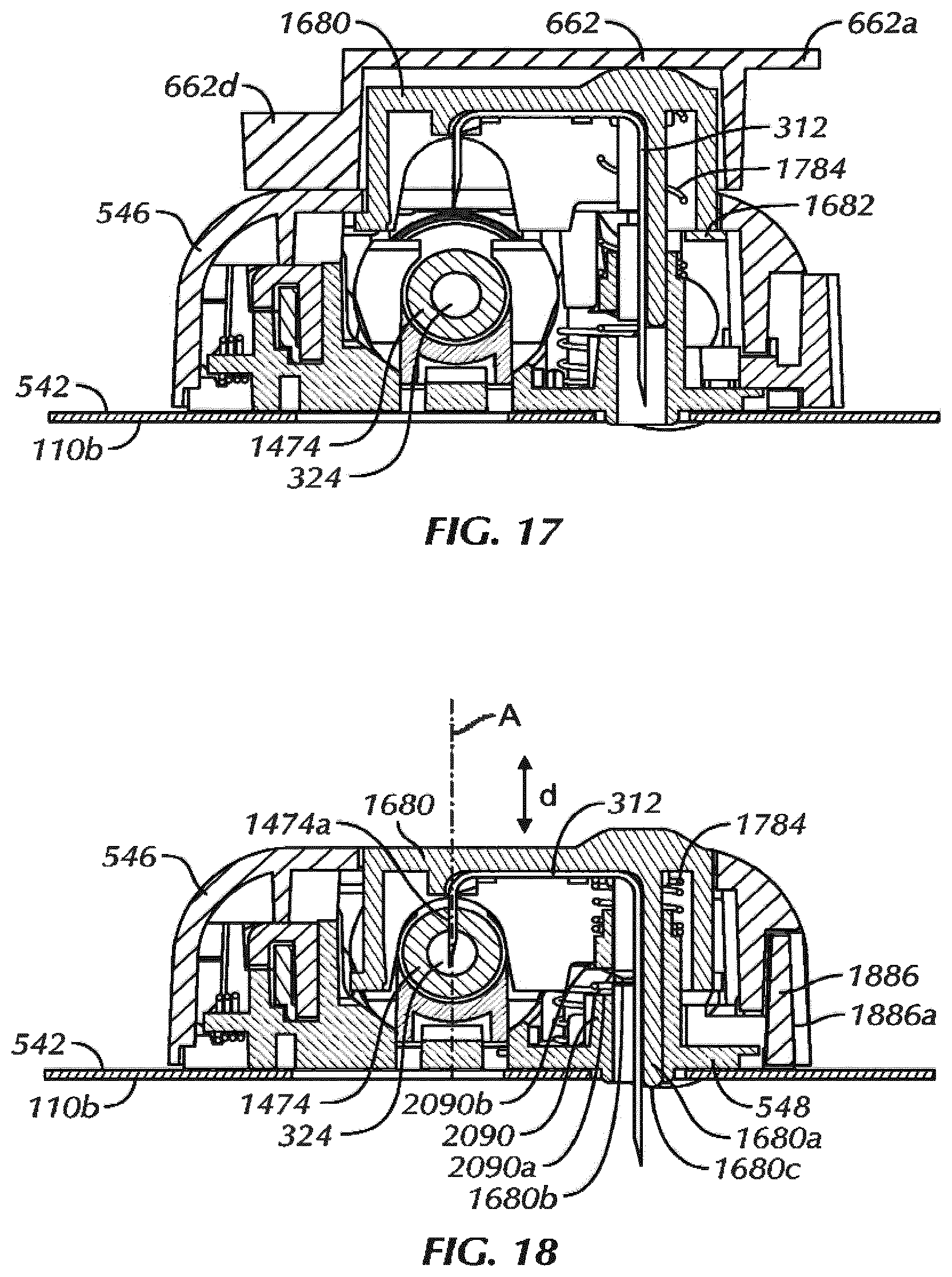 Patent US12576093 Figure 16 – Pharmaceutical composition for subcutaneous administration