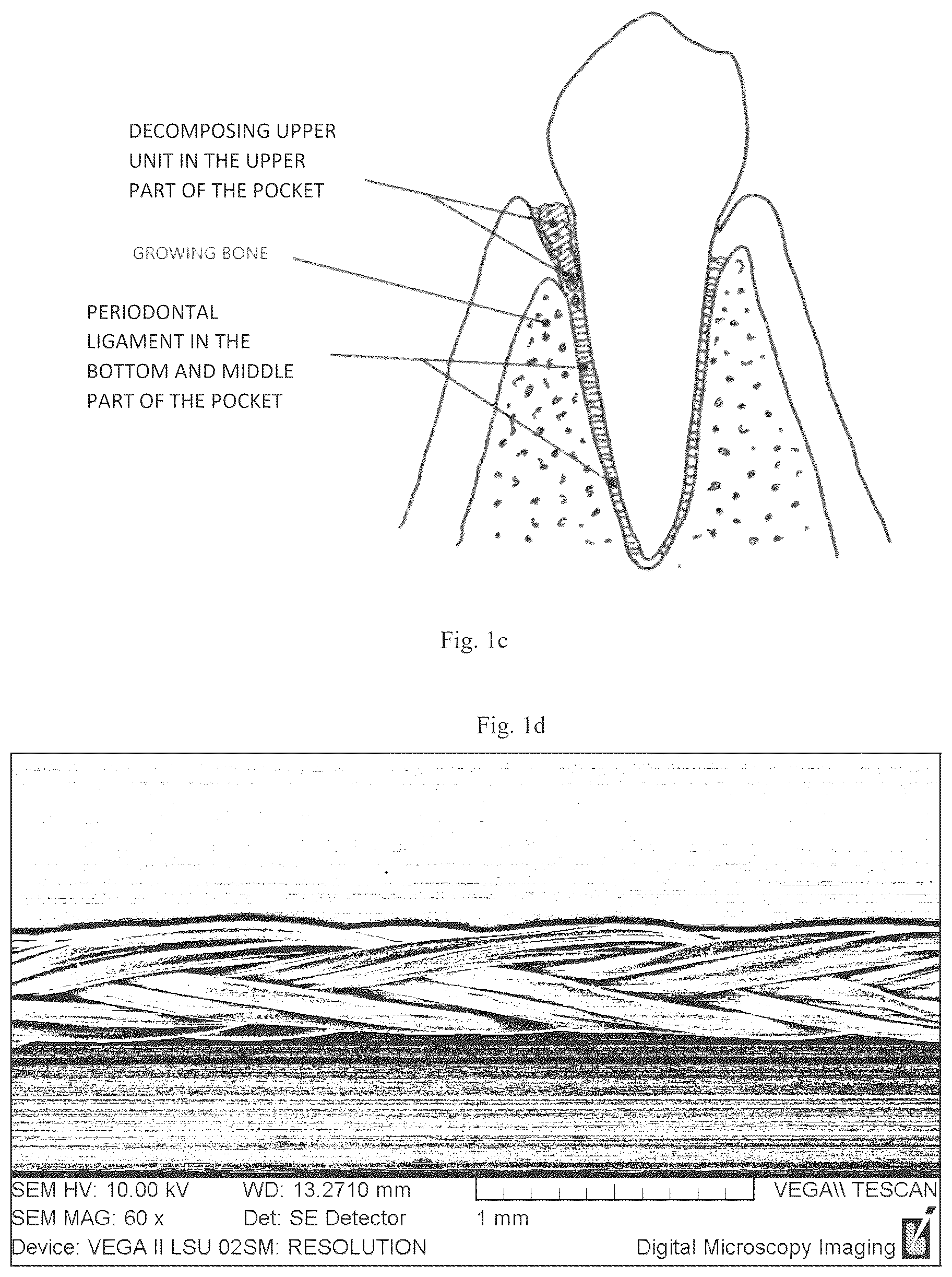 Patent US12576104 Figure 2 – Dental preparation comprising fibers based on hyaluronic acid with regulated biodegradability